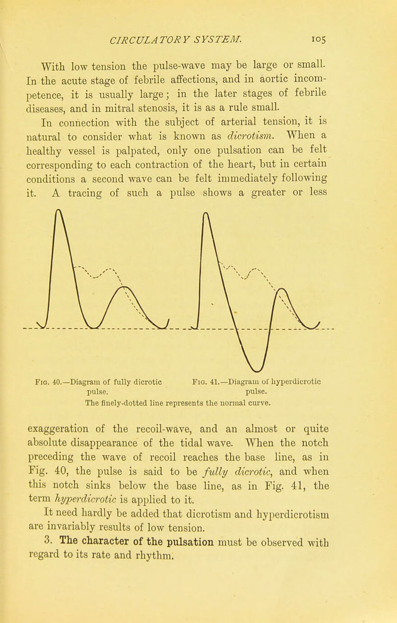 With low tension the pulse-wave may be large or small. In the acute stage of febrile affections, and in aortic incom- petence, it is usually large; in the later stages of febrile diseases, and in mitral stenosis, it is as a rule small. In connection with the subject of arterial tension, it is natural to consider what is known as dicrotism. When a healthy vessel is palpated, only one pulsation can be felt corresponding to each contraction of the heart, but in certain conditions a second wave can be felt immediately following it. A tracing of such a pulse shows a greater or less Fio. 40.—Diagram of fully dicrotic Fig. 41.—Diagram of hyperdicrotic pulse. pulse. The finely-dotted line represents the normal curve. exaggeration of the recoil-wave, and an almost or quite absolute disappearance of the tidal wave. When the notch preceding the wave of recoil reaches the base line, as in Fig. 40, the pulse is said to be fully dicrotic, and when this notch sinks below the base line, as in Fig. 41, the term hyperdicrotic is applied to it. It need hardly be added that dicrotism and hyperdicrotism are invariably results of low tension. 3. The character of the pulsation must be observed with regard to its rate and rhythm.