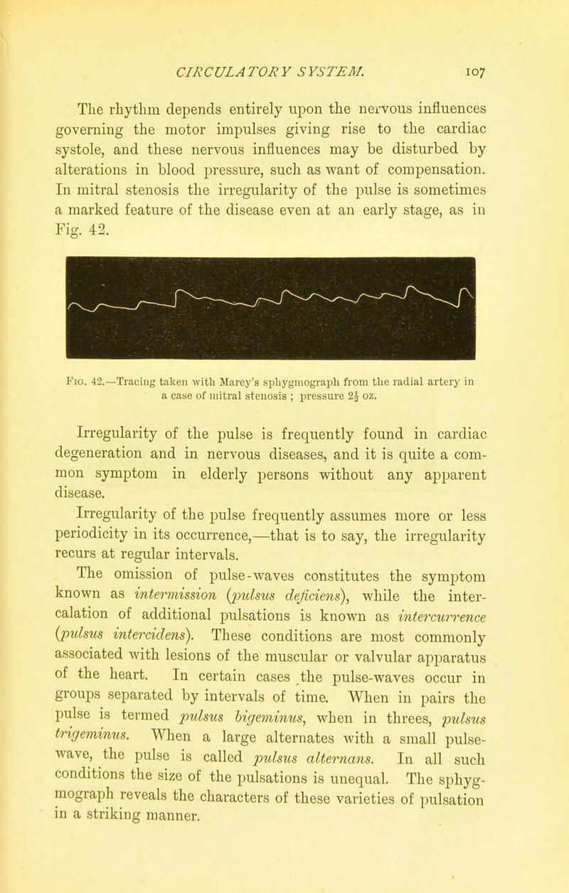 The rhythm depends entirely upon the nervous influences governing the motor impulses giving rise to the cardiac systole, and these nervous influences may be disturbed by alterations in blood i^ressure, such as v^ant of compensation. In mitral stenosis the irregularity of the pulse is sometimes a marked feature of the disease even at an early stage, as in Fig. 42. Fio. 42.—Tracing taken with Maroy's spliygmograpli from the radial artery in a case of mitral stenosis ; pressure 2j oz. Irregularity of the pulse is frequently found in cardiac degeneration and in nervous diseases, and it is quite a com- mon symptom in elderly persons without any apparent disease. Irregularity of the pulse frequently assumes more or less periodicity in its occurrence,—that is to say, the irregularity recurs at regular intervals. The omission of pulse-waves constitutes the symptom known as interinission (jmlsus deficiens), while the inter- calation of additional pulsations is known as intercurrence (pulsus intercidens). These conditions are most commonly associated with lesions of the muscular or valvular apparatus of the heart. In certain cases the pulse-waves occur in groups separated by intervals of time. When in pairs the pulse is termed pulsus higeminus, when in threes, pulsus trigeminus. When a large alternates with a small pulse- wave, the pulse is called pulsus alternans. In all such conditions the size of the pulsations is unequal. The sphyg- mograph reveals the characters of these varieties of pulsation in a striking manner.