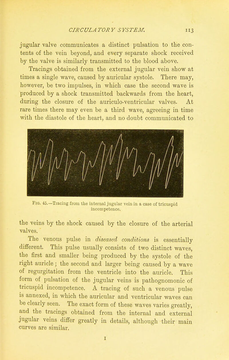 jugular valve communicates a distinct pulsation to the con- tents of the vein beyond, and every separate shock received by the valve is similarly transmitted to the blood above. Tracings obtained from the external jugular vein show at times a single wave, caused by auricular systole. There may, however, be two impulses, in which case the second wave is produced by a shock transmitted backwards from the heart, during the closure of the auriculo-ventricular valves. At rare times there may even be a third wave, agreeing in time with the diastole of the heart, and no doubt communicated to Fig. 45.—Tracing from the internal jugular vein in a case of tricuspid incompetence. the veins by the shock caused by the closure of the arterial valves. The venous pulse in diseased conditions is essentially different. This pulse usually consists of two distinct waves, the first and smaller being produced by the systole of the right auricle; the second and larger being caused by a wave of regurgitation from the ventricle into the auricle. This form of pulsation of the jugular veins is pathognomonic of tricuspid incompetence. A tracing of such a venous pulse is annexed, in which the auricular and ventricular waves can be clearly seen. The exact form of these waves varies greatly, and the tracings obtained from the internal and external jugular veins differ greatly in details, although their main curves are similar. I