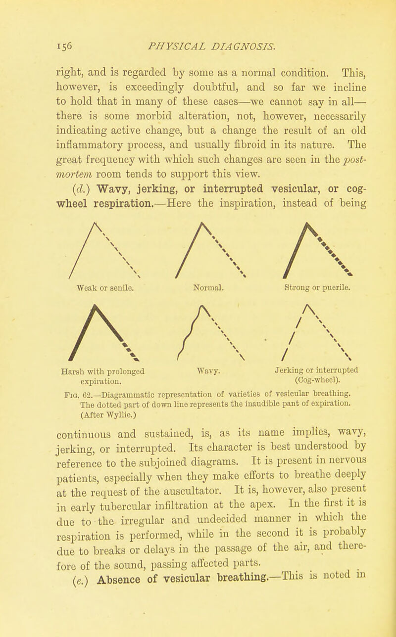 right, and is regarded by some as a normal condition. This, however, is exceedingly doubtfid, and so far we incline to hold that in many of these cases—we cannot say in all— there is some morbid alteration, not, however, necessarilj' indicating active change, but a change the result of an old inflammatory process, and usually fibroid in its nature. The great frequency vnth which such changes are seen in the post- mortem room tends to support this view. {(1.) Wavy, jerking, or interrupted vesicular, or cog- wheel respiration.—Here the inspiration, instead of being Weak or senile. A Normal. strong or puerile. A / / / Harsh with prolongod expiration Wavy. Jerking or interrupted (Cog-wheel). Pig. 62.—Diagrammatic representation of varieties of vesicular breathing. The dotted part of down line represents the inaudible pant of expiration. (After Wyllie.) continuous and sustained, is, as its name implies, wavy, jerking, or interrupted. Its character is best understood by reference to the subjoined diagrams. It is present in nervous patients, especially when they make efl^orts to breathe deeply at the request of the auscultator. It is, however, also present in early tubercular infiltration at the apex. In the first it is due to the irregular and undecided manner in which the respiration is performed, while in the second it is probably due to breaks or delays in the passage of the air, and there- fore of the sound, passing affected parts. (e.) Absence of vesicular breathing.—This is noted m