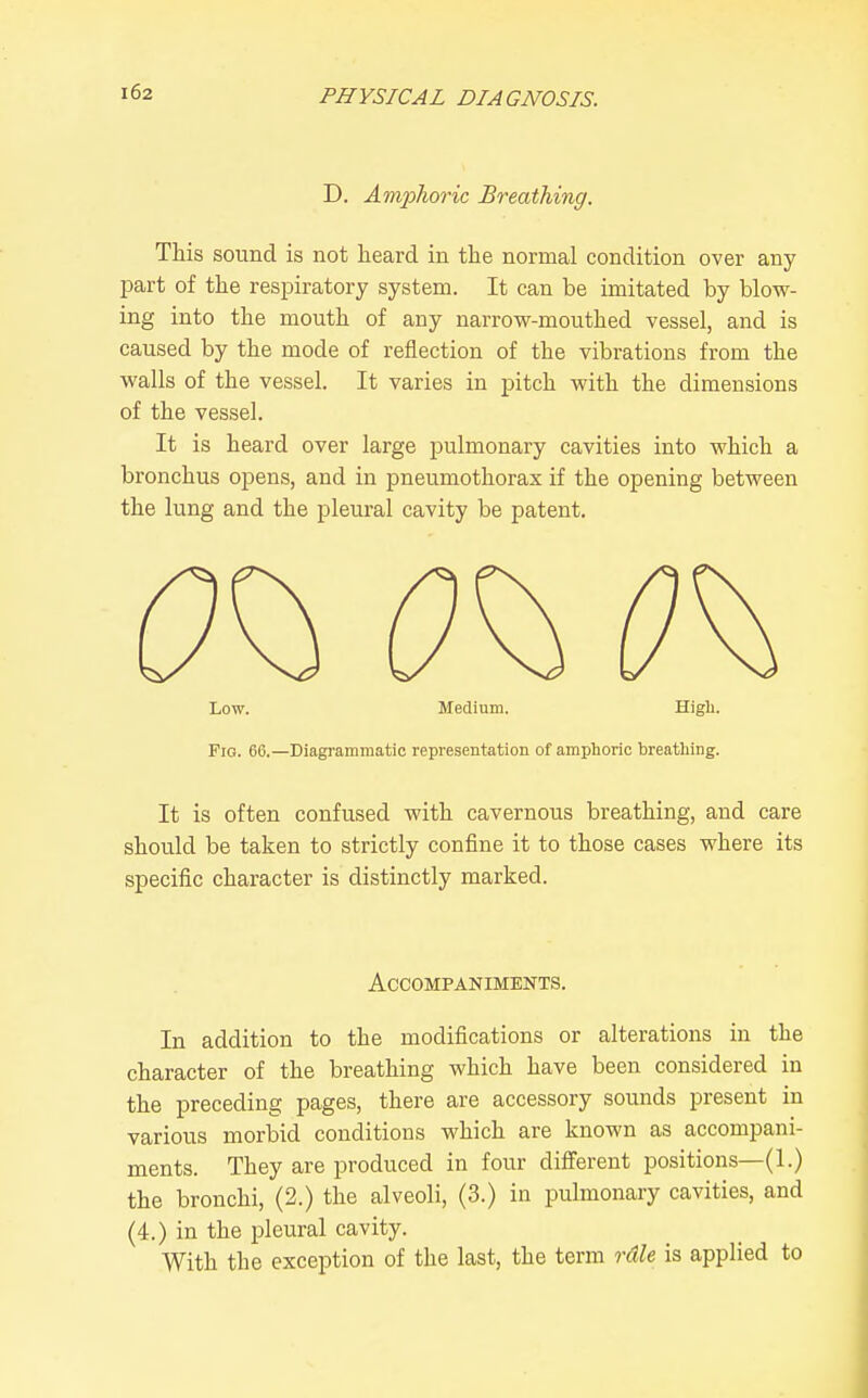D. Amiolwric Breathing. This sound is not heard in the normal condition over any part of the respiratory system. It can be imitated by blow- ing into the mouth of any narrow-mouthed vessel, and is caused by the mode of reflection of the vibrations from the walls of the vessel. It varies in pitch with the dimensions of the vessel. It is heard over large pulmonary cavities into which a bronchus opens, and in pneumothorax if the opening between the lung and the pleural cavity be patent. Low. Medium. Higli. Fig. 60.—Diagrammatic representation of amphoric breathing. It is often confused with cavernous breathing, and care should be taken to strictly confine it to those cases where its specific character is distinctly marked. Accompaniments. In addition to the modifications or alterations in the character of the breathing which have been considered in the preceding pages, there are accessory sounds present in various morbid conditions which are known as accompani- ments. They are produced in four difi'erent positions—(1.) the bronchi, (2.) the alveoli, (3.) in pulmonary cavities, and (4.) in the pleural cavity. With the exception of the last, the term rdU is applied to
