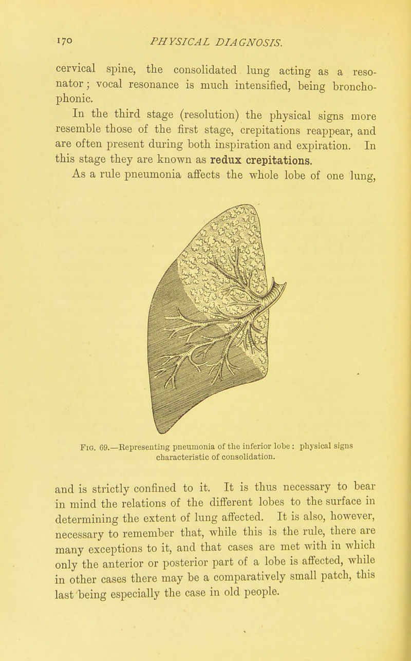 cervical spine, the consolidated lung acting as a reso- nator ; vocal resonance is much intensified, being broncho- phonic. In the third stage (resolution) the physical signs more resemble those of the first stage, crepitations reappear, and are often present during both inspiration and expiration. In this stage they are known as redux crepitations. As a rule pneumonia afiects the whole lobe of one lung. Fio. 69.—Representing pneumonia of the inferior lobe : physical signs characteristic of consolidation. and is strictly confined to it. It is thus necessary to bear in mind the relations of the diS'erent lobes to the surface in determining the extent of lung afiected. It is also, however, necessary to remember that, while this is the rule, there are many exceptions to it, and that cases are met with in which only the anterior or posterior part of a lobe is affected, whUe in other cases there may be a comparatively small patch, this last being especially the case in old people.