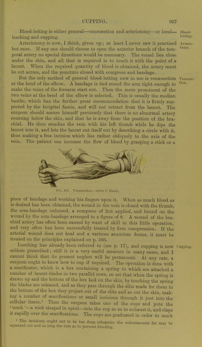 Blood-letting is either general—venaesection and arteriotomy—or local— Blood- leeching and cupping. lettmg. Arteriotomy is now, I think, given up ; at least I never saw it practised Arterio- but once. If any one should choose to open the anterior branch of the tern- ^°^^y- poral artery no special directions would be necessary. The vessel lies close under the skin, and all that is required is to touch it with the point of a lancet. When the required quantity of blood is obtained, the artery must be cut across, and the puncture closed with compress and bandage. But the only method of general blood-letting now in use is venaesection Ventesdc- at the bend of the elbow. A bandage is tied round the arm tight enough to make the veins of the forearm start out. Then the more prominent of the two veins at the bend of the elbow is selected. This is usually the median basihc, which has the further great recommendation that it is firmly sup- ported by the bicipital fascia, and will not retract from the lancet. The surgeon should assure himself previously that there is no abnormal artery coursing below the skin, and that he is away from the position of the bra- chial. He then steadies the vein with his left thumb while he dips the lancet into it, and lets the lancet cut itself out by describing a circle with it, thus making a free incision which lies rather obliquely to the axis of the vein. The patient can increase the flow of blood by grasping a stick or a 411. VeuEBsectiou.—After C. Heath. piece of bandage and working his fingers upon it. When as much blood as is desired has been obtained, the wound in the vein is closed with the thumb, the arm-bandage unloosed, a compress of hnt appHed, and bound on the wound by the arm-bandage arranged in a figure of 8. A wound of the bra- chial artery has often been caused by want of skill in this little operation, and very often has been successfully treated by firm compression. If the arterial wound does not heal and a varicose aneurism forms, it must be treated on the principles explained on p. 566. Leeching has already been referred to (see p. 17), and cupping is now Cupping, seldom prescribed; stiU it is a very useful measure in many cases, and I cannot think that its present neglect will be permanent. At any rate, a surgeon ought to know how to cup if required. The operation is done with a scarificator, which is a box containing a spring to which are attached a number of lancet-blades in two parallel rows, so set that when the spring is drawn up and the bottom of the box laid on the skin, by touching the spring the blades are released, and as they pass through the slits made for them in the bottom of the box they project out of the slits and'so cut tlie skin, mak- ing a number of scarifications or small incisions through it just into the ceUular tissue.' Then the surgeon takes one of the cups and puts the ' torch '—a wick steeped in spirit—into the cup so as to exhaust it, and claps It rapidly over the scarifications. The cups are graduated m order to mark ' The incisions ought not to be too deep, otherwise the subcutaneous fat may be squeezed out and so plug the cuts as to prevent bleeding.