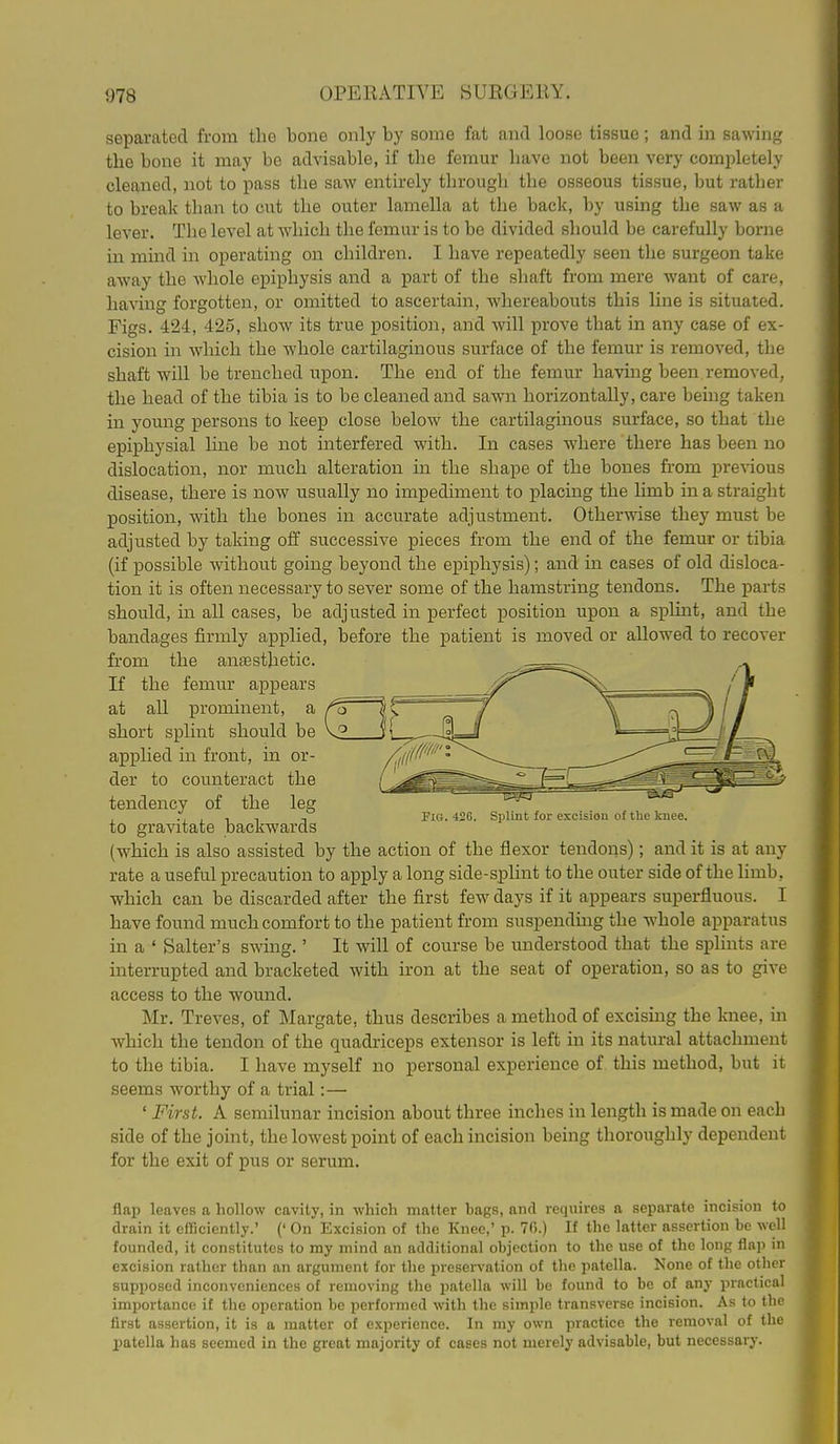 separated from the bone only by some fat and loose tissue; and in sawing the bone it may bo advisable, if the femur have not been very completely cleaned, not to pass the saw entirely through the osseous tissue, but rather to break than to cut the outer lamella at the back, by using the saw as a lever. The level at which the femur is to be divided should be carefully borne in mind in operating on children. I have repeatedly seen the surgeon take away the whole epiphysis and a part of the shaft from mere want of care, having forgotten, or omitted to ascertain, whereabouts this line is situated. Figs. 424, 425, show its true position, and will prove that in any case of ex- cision in which the whole cartilaginous surface of the femur is removed, the shaft will be trenched upon. The end of the femur having been removed, the head of the tibia is to be cleaned and sawn horizontally, care being taken in young persons to keep close below the cartilaginous surface, so that the epiphysial line be not interfered with. In cases where there has been no dislocation, nor much alteration in the shape of the bones from previous disease, there is now usually no impediment to placing the limb in a straight position, with the bones in accurate adjustment. Otherwise they must be adjusted by taking off successive pieces from the end of the femur or tibia (if possible without going beyond the epiphysis); and in cases of old disloca- tion it is often necessary to sever some of the hamstring tendons. The parts should, in all cases, be adjusted in perfect position upon a splint, and the bandages firmly applied, before the patient is moved or allowed to recover from the antesthetic. If the femur appears at all prominent, a short splint should be apphed in front, in or- der to counteract the tendency of the leg to gravitate backwards (which is also assisted by the action of the flexor tendons); and it is at any rate a useful precaution to apply a long side-splint to the outer side of the limb, which can be discarded after the first few days if it appears superfluous. I have found much comfort to the patient from suspendmg the whole apparatus in a ' Salter's swmg.' It will of course be understood that the splints are interrupted and bracketed with iron at the seat of operation, so as to give access to the wound. Mr. Treves, of Margate, thus describes a method of excising the Imee, in which the tendon of the quadriceps extensor is left in its natural attachment to the tibia. I have myself no personal experience of this method, but it seems worthy of a trial:— ' First. A semilunar incision about three inches in length is made on each side of the joint, the lowest point of each incision being thoroughly dependent for the exit of pus or serum. FiG. 420. Splint for excision of the knee. flap leaves a hollow cavity, in which matter bags, and requires a separate incision to drain it efficiently.' (' On Excision of the Knee,' p. 7fi.) If the latter assertion be well founded, it constitutes to my mind an additional objection to the use of the long flap in excision rather than an argument for the preservation of the patella. None of the other supposed inconveniences of removing the patella will be found to be of any practical importance if the operation be performed with the simple transverse incision. As to the first assertion, it is a matter of experience. In my own practice the removal of the patella has seemed in the great majority of cases not merely advisable, but necessary.