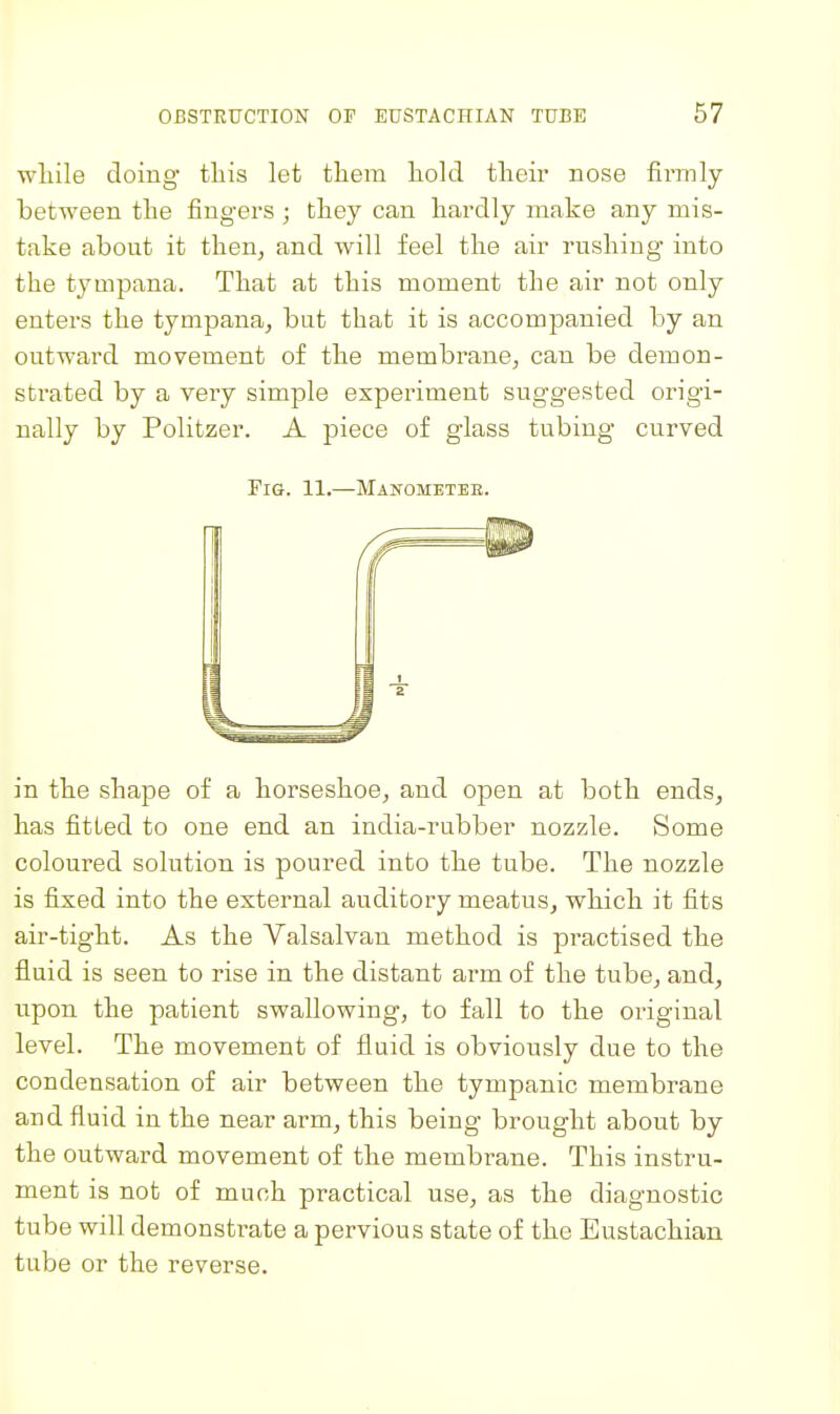 wliile doing tliis let them liold their nose firmly between the fingers ; they can hardly make any mis- take about it then, and will feel the air rushing into the tympana. That at this moment the air not only enters the tympana, but that it is accompanied by an outward movement of the membrane, can be demon- strated by a very simple experiment suggested origi- nally by Politzer. A piece of glass tubing curved Fig. 11.—Manometee. in the shape of a horseshoe, and open at both ends, has fitted to one end an india-rubber nozzle. Some coloured solution is poured into the tube. The nozzle is fixed into the external auditory meatus, which it fits air-tight. As the Valsalvan method is practised the fluid is seen to rise in the distant arm of the tube, and, upon the patient swallowing, to fall to the original level. The movement of fluid is obviously due to the condensation of air between the tympanic membrane and fluid in the near arm, this being brought about by the outward movement of the membrane. This instru- ment is not of much practical use, as the diagnostic tube will demonstrate a pervious state of the Eustachian tube or the reverse.