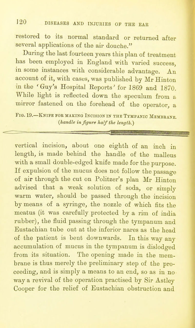 restored to its normal standard or returned after several applications of the air douche. During the last fourteen years this plan of treatment has been employed in England with varied success, in some instances with considerable advantage. An account of it, with cases, was published by Mr Hinton in the 'Guy's Hospital Reports' for 1869 and 1870. While light is reflected down the speculum from a mirror fastened on the forehead of the operator, a Fig. 19.—Knife fob making Incision in the Tympanic Membeane. {handle in figure half the length.) vertical incision, about one eighth of an inch in length, is made behind the handle of the maUeus with a small double-edged knife made for the purpose. If expulsion of the mucus does not follow the passage of air through the cut on Politzer's plan Mr Hinton advised that a weak solution of soda, or simply warm water, should be passed through the incision by means of a syringe, the nozzle of which fits the meatus (it was carefully protected by a rim of india rubber), the fluid passing through the tympanum and Eustachian tube out at the inferior nares as the head of the patient is bent downwards. In this way any accumulation of mucus in the tympanum is dislodged from its situation. The opening made in the mem- brane is thus merely the preliminary step of the pro- ceeding, and is simply a means to an end, so as in no way a revival of the operation practised by Sir Astley Cooper for the relief of Eustachian obstruction and