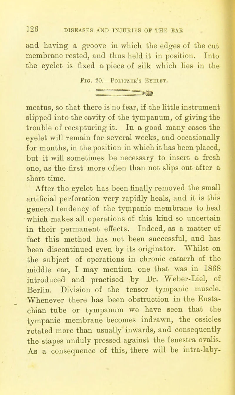 and having a groove in wliicli the edges of the cut membrane rested, and thus held it in position. Into the eyelet is fixed a piece of silk which lies in the Fig. 20.—Politzee's Ktelet. ^^^^^^^ meatus, so that there is no fear, if the little instrument slipped into the cavity of the tympanum, of giving the ti'ouble of recapturing it. In a good many cases the eyelet will remain for several weeks, and occasionally for months, in the position in which it has been placed, but it will sometimes be necessary to insert a fresh one, as the first more often than not slips out after a short time. After the eyelet has been finally removed the small artificial perforation very rapidly heals, and it is this general tendency of the tympanic membrane to heal which makes all operations of this kind so uncertain in their permanent effects. Indeed, as a matter of fact this method has not been successful, and has been discontinued even by its originator. Whilst on the subject of operations in chronic catarrh of the middle ear, I may mention one that was in 1868 introduced and practised by Dr. Weber-Liel, of Berlin. Division of the tensor tympanic muscle. Whenever there has been obstruction in the Eusta- chian tube or tympanum we have seen that the tympanic membrane becomes indi-awn, the ossicles rotated more than usually inwards, and consequently the stapes unduly pressed against the fenestra ovalis. As a consequence of this, there will be intra-laby-