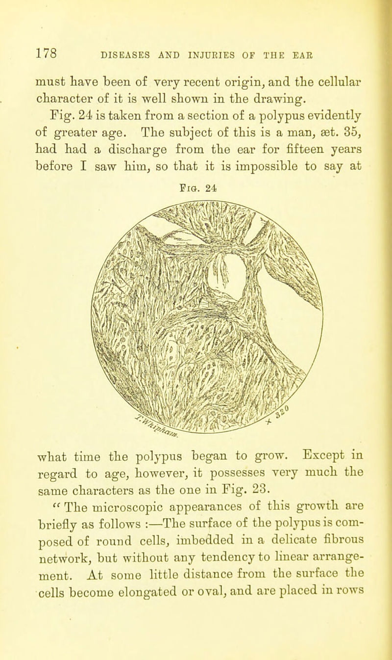 must have been of very recent origin, and the cellular character of it is well shown in the drawing. Fig. 24 is taken from a section of a polypus evidently of greater age. The subject of this is a man, aet. 35, had had a discharge from the ear for fifteen years before I saw him, so that it is impossible to say at Fig. 24 what time the polypus began to grow. Except in regard to age, however, it possesses very much the same characters as the one in Fig. 23.  The microscopic appearances of this growth are briefly as follows :—The surface of the polypus is com- posed of round cells, imbedded in a delicate fibrous network, but without any tendency to linear arrange- ment. At some little distance from the surface the cells become elongated or oval, and are placed in i-ows