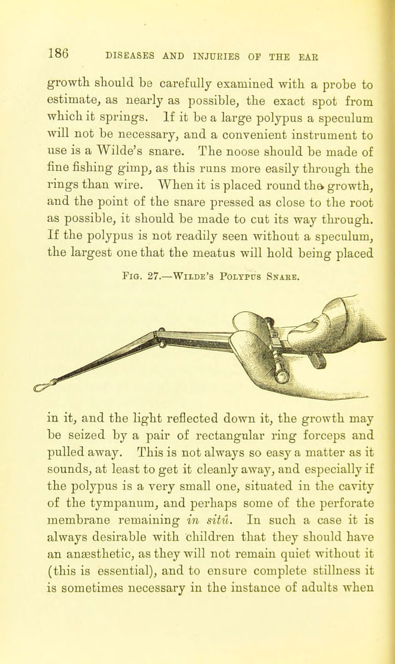 growtli sliould be carefully examined with a probe to estimate^ as nearly as possiblej the exact spot from which it springs. If it be a large poly]3us a speculum will not be necessary, and a convenient instrument to use is a Wilde's snare. The noose should be made of fine fishing gimp, as this runs more easQy through the rings than wire. When it is placed round th& growth, and the point of the snare pressed as close to the root as possible, it should be made to cut its way tkrough. If the polypus is not readily seen without a speculum, the largest one that the meatus will hold being placed Fie. 27.—Wilde's Polypus Snaee. in it, and the light reflected down it, the growth may be seized by a pair of rectangular ring forceps and pulled away. This is not always so easy a matter as it sounds, at least to get it cleanly away, and especially if the polypus is a very small one, situated in the cavity of the tympanum, and perhaps some of the perforate membrane remaining in situ. In such a case it is always desirable with children that they should have an anassthetic, as they will not remain quiet without it (this is essential), and to ensure complete stillness it is sometimes necessary in the instance of adults when