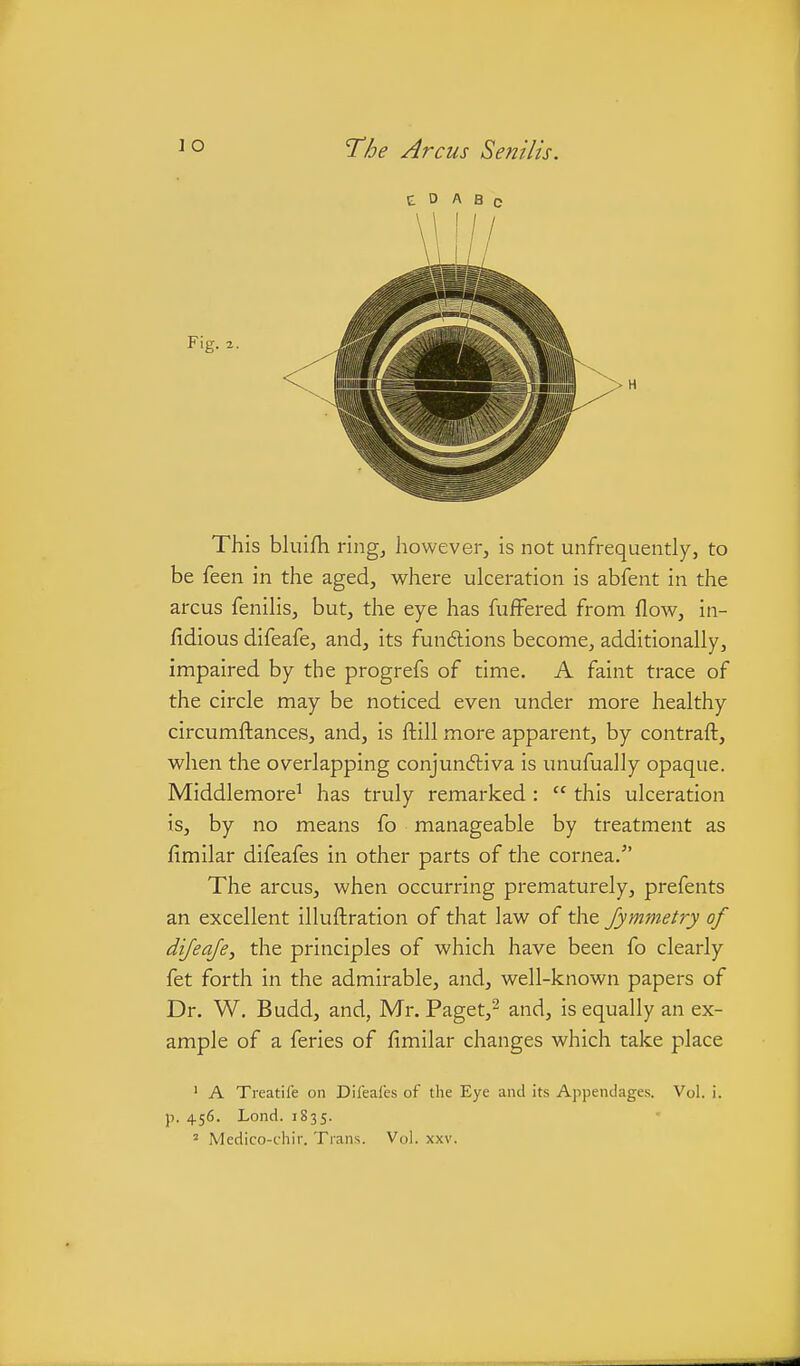 E D A B c This bluifh nng^ however, is not unfrequently, to be feen in the aged, where ulceration is abfent in the arcus feniHs, but, the eye has fufFered from flow, in- fidious difeafe, and, its fundions become, additionally, impaired by the progrefs of time. A faint trace of the circle may be noticed even under more healthy circumftances, and, is ftill more apparent, by contraft, when the overlapping conjundliva is unufually opaque. Middlemore^ has truly remarked:  this ulceration is, by no means fo manageable by treatment as fimilar difeafes in other parts of the cornea. The arcus, when occurring prematurely, prefents an excellent illuftration of that law of the Jymmetry of dijeafe, the principles of which have been fo clearly fet forth in the admirable, and, well-known papers of Dr. W, Budd, and, Mr. Paget,^ and, is equally an ex- ample of a feries of fimilar changes which take place ' A Tieatife on Difeafes of the Eye and its Appendages. Vol. i. p. 456. Lond. 1835. ^ Medico-chir. Tians. Vol. xxv.