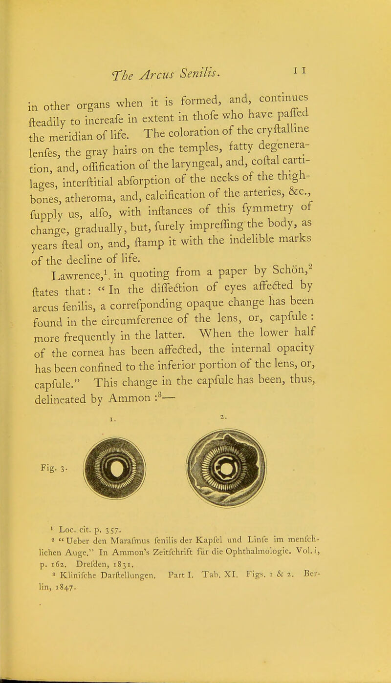 in other organs when it is formed, and continues fteadily to increafe in extent In thofe who have paffed the meridian of Hfe. The coloration of the cryftallme lenfes, the gray hairs on the temples, fatty degenera- tion, and, offification of the laryngeal, and, coftal carti- lages, interftitial abforption of the necks of the thigh- bones, atheroma, and, calcification of the arteries, &c fupply us, alfo, with inftances of this fymmetry ot change, gradually, but, furely impreffing the body, as years fteal on, and, ftamp it with the indelible marks of the decline of life. Lawrence,!, in quoting from a paper by Schon, ftates that:  In the diffeftion of eyes affefted by arcus fenilis, a correfponding opaque change has been found in the circumference of the lens, or, capfule : more frequently in the latter. When the lower half of the cornea has been affedted, the internal opacity has been confined to the inferior portion of the lens, or, capfule. This change in the capfule has been, thus, delineated by Ammon '?— Fig. 3- ' Loc. cit. p. 357. 2  Ueber den Marafmus fenilis der Kapfel und Linfe im menfch lichen Auge. In Amnion's Zeltfchrift fiir die Ophthalmologic. Vol, i p. 162. Drefden, 1831. ' Klinifche Daiftellungen. Part I. Tab. XI. Figs, i & 2. Ber lin, 1847.