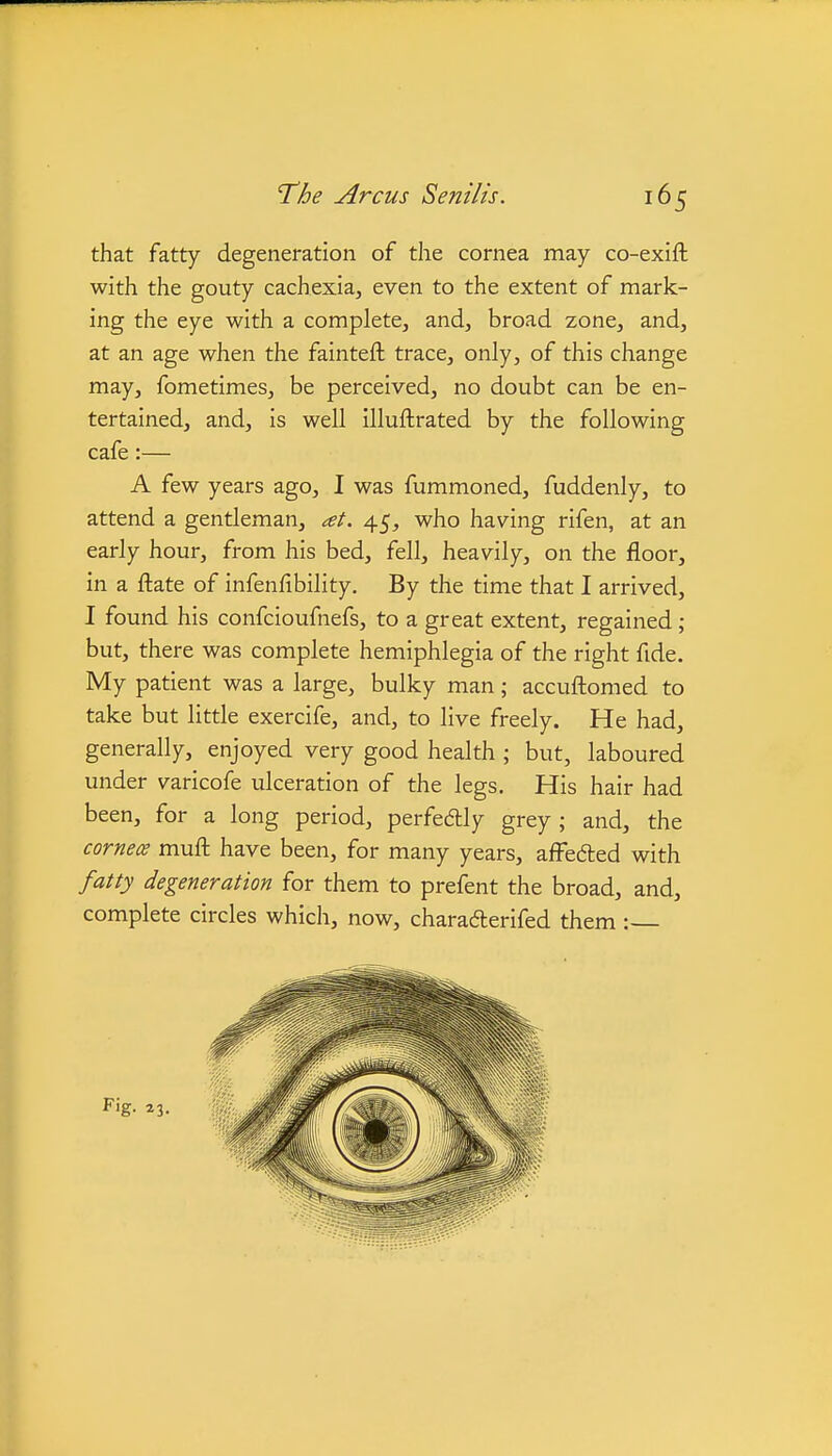 that fatty degeneration of the cornea may co-exift with the gouty cachexia, even to the extent of mark- ing the eye with a complete, and, broad zone, and, at an age when the fainteft trace, only, of this change may, fometimes, be perceived, no doubt can be en- tertained, and, is well illuftrated by the following cafe :— A few years ago, I was fummoned, fuddenly, to attend a gentleman, at. 45, who having rifen, at an early hour, from his bed, fell, heavily, on the floor, in a ftate of infenfibility. By the time that I arrived, I found his confcioufnefs, to a great extent, regained; but, there was complete hemiphlegia of the right fide. My patient was a large, bulky man; accuftomed to take but little exercife, and, to live freely. He had, generally, enjoyed very good health ; but, laboured under varicofe ulceration of the legs. His hair had been, for a long period, perfedly grey ; and, the cornea muft have been, for many years, afFedled with fatty degeneration for them to prefent the broad, and, complete circles which, now, charadlerifed them :