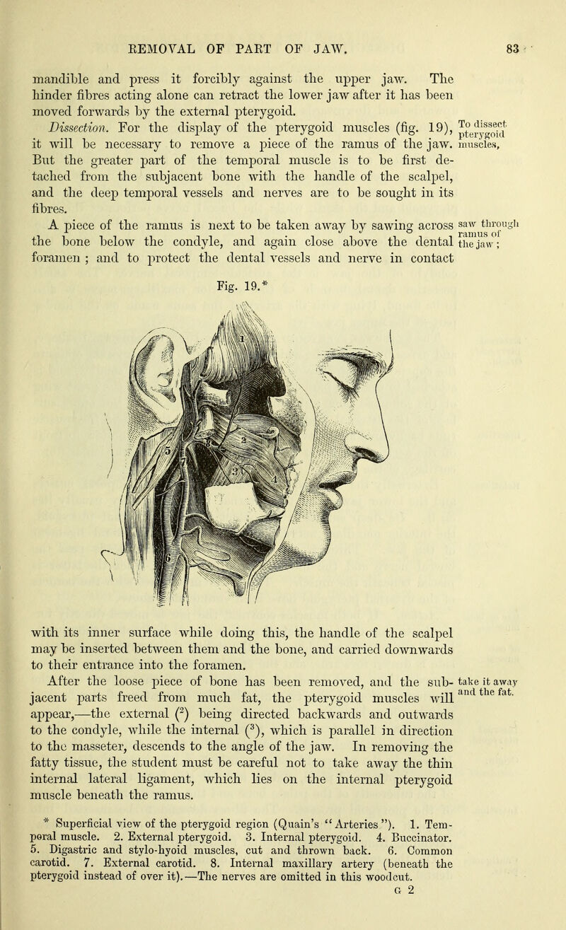 mandible and press it forcibly against the upper jaw. The hinder fibres acting alone can retract the lower jaw after it has been moved forwards by the external pterygoid. Dissection. For the display of the pterygoid muscles (fig. 19), p^y^f' it will be necessary to remove a piece of the ramus of the jaw. muscles, But the greater part of the temporal muscle is to be first de- tached from the subjacent bone with the handle of the scalpel, and the deep temporal vessels and nerves are to be sought in its fibres. A piece of the ramus is next to be taken away by sawing across saw through the bone below the condyle, and again close above the dental the jaw; foramen ; and to protect the dental vessels and nerve in contact Fig. 19.* with its inner surface while doing this, the handle of the scalpel may be inserted between them and the bone, and carried downwards to their entrance into the foramen. After the loose piece of bone has been removed, and the sub- take it away jacent parts freed from much fat, the pterygoid muscles willand the fat appear,—the external (2) being directed backwards and outwards to the condyle, while the internal (3), which is parallel in direction to the masseter, descends to the angle of the jaw. In removing the fatty tissue, the student must be careful not to take away the thin internal lateral ligament, which lies on the internal pterygoid muscle beneath the ramus. * Superficial view of the pterygoid region (Quain's Arteries ). 1. Tem- poral muscle. 2. External pterygoid. 3. Internal pterygoid. 4. Buccinator. 5. Digastric and stylo-hyoid muscles, cut and thrown back. 6. Common carotid. 7. External carotid. 8. Internal maxillary artery (beneath the pterygoid instead of over it).—The nerves are omitted in this woodcut. G 2