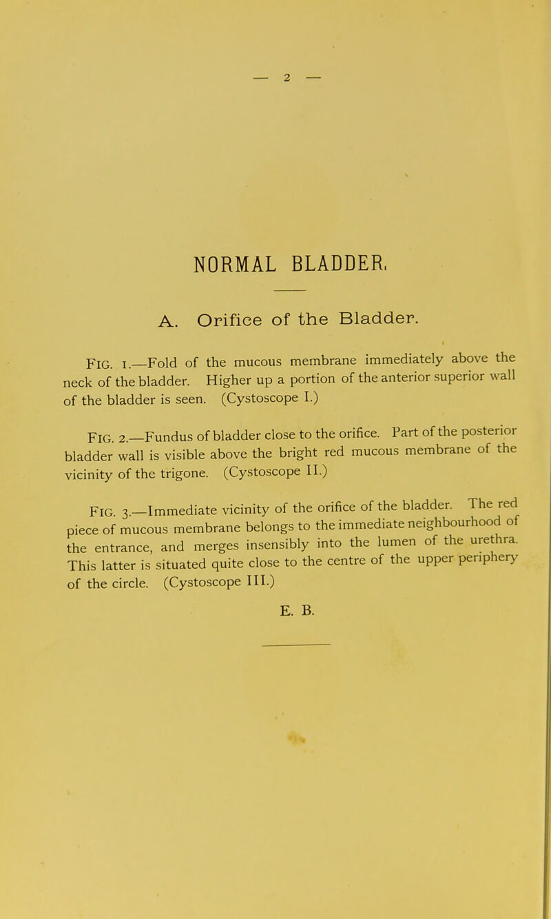 NORMAL BLADDER. A. Orifice of the Bladder. Fig. I.—Fold of the mucous membrane immediately above the neck of the bladder. Higher up a portion of the anterior superior wall of the bladder is seen. (Cystoscope I.) Fig. 2.—Fundus of bladder close to the orifice. Part of the posterior bladder wall is visible above the bright red mucous membrane of the vicinity of the trigone. (Cystoscope II.) Fig 3.—Immediate vicinity of the orifice of the bladder. The red piece of mucous membrane belongs to the immediate neighbourhood of the entrance, and merges insensibly into the lumen of the urethra. This latter is situated quite close to the centre of the upper periphery of the circle. (Cystoscope III.) E. B.