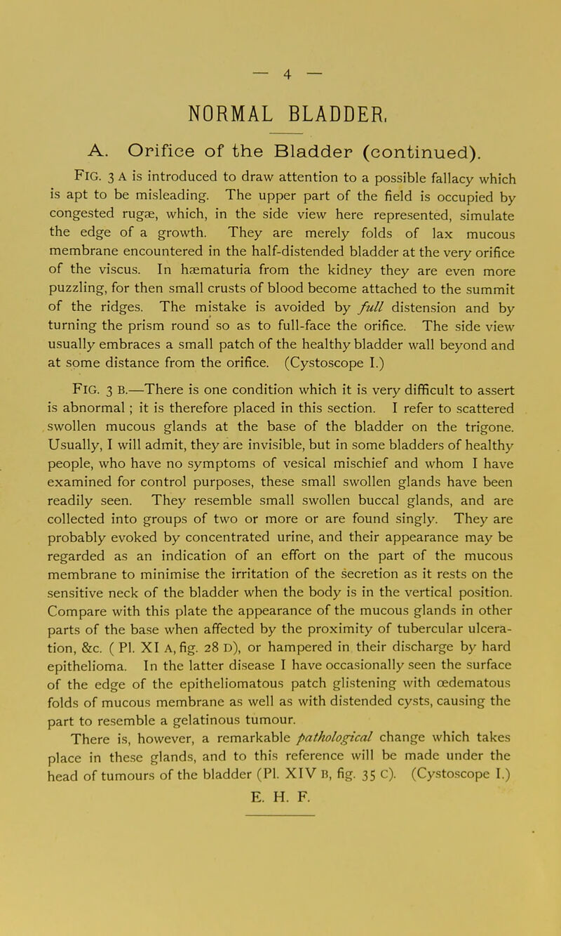 — 4 — NORMAL BLADDER. A. Orifice of the Bladder (continued). Fig. 3 a is introduced to draw attention to a possible fallacy which is apt to be misleading. The upper part of the field is occupied by- congested rugae, which, in the side view here represented, simulate the edge of a growth. They are merely folds of lax mucous membrane encountered in the half-distended bladder at the very orifice of the viscus. In haematuria from the kidney they are even more puzzling, for then small crusts of blood become attached to the summit of the ridges. The mistake is avoided by full distension and by turning the prism round so as to full-face the orifice. The side view usually embraces a small patch of the healthy bladder wall beyond and at some distance from the orifice. (Cystoscope I.) Fig. 3 B.—There is one condition which it is very difficult to assert is abnormal ; it is therefore placed in this section. I refer to scattered swollen mucous glands at the base of the bladder on the trigone. Usually, I will admit, they are invisible, but in some bladders of healthy people, who have no symptoms of vesical mischief and whom I have examined for control purposes, these small swollen glands have been readily seen. They resemble small swollen buccal glands, and are collected into groups of two or more or are found singly. They are probably evoked by concentrated urine, and their appearance may be regarded as an indication of an effort on the part of the mucous membrane to minimise the irritation of the secretion as it rests on the sensitive neck of the bladder when the body is in the vertical position. Compare with this plate the appearance of the mucous glands in other parts of the base when affected by the proximity of tubercular ulcera- tion, &c. ( PI. XI A, fig. 28 d), or hampered in their discharge by hard epithelioma. In the latter disease I have occasionally seen the surface of the edge of the epitheliomatous patch glistening with oedematous folds of mucous membrane as well as with distended cysts, causing the part to resemble a gelatinous tumour. There is, however, a remarkable pathological change which takes place in the.se glands, and to this reference will be made under the head of tumours of the bladder (PI. XIV B, fig. 35 c). (Cystcscope I.) E. H. F.