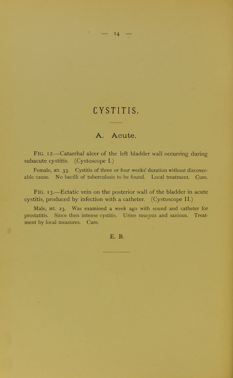 CYSTITIS. A. Acute. Fig. 12.—Catarrhal ulcer of the left bladder wall occurring during subacute cystitis. (Cystoscope I.) Female, set. 33. Cystitis of three or four weeks' duration without discover- able cause. No bacilli of tuberculosis to be found. Local treatment. Cure. Fig. 13.—Ectatic vein on the posterior wall of the bladder in acute cystitis, produced by infection with a catheter. (Cystoscope II.) Male, aet. 23. Was examined a week ago with sound and catheter for prostatitis. Since then intense cystitis. Urine mucous and sanious. Treat- ment by local measures. Cure.