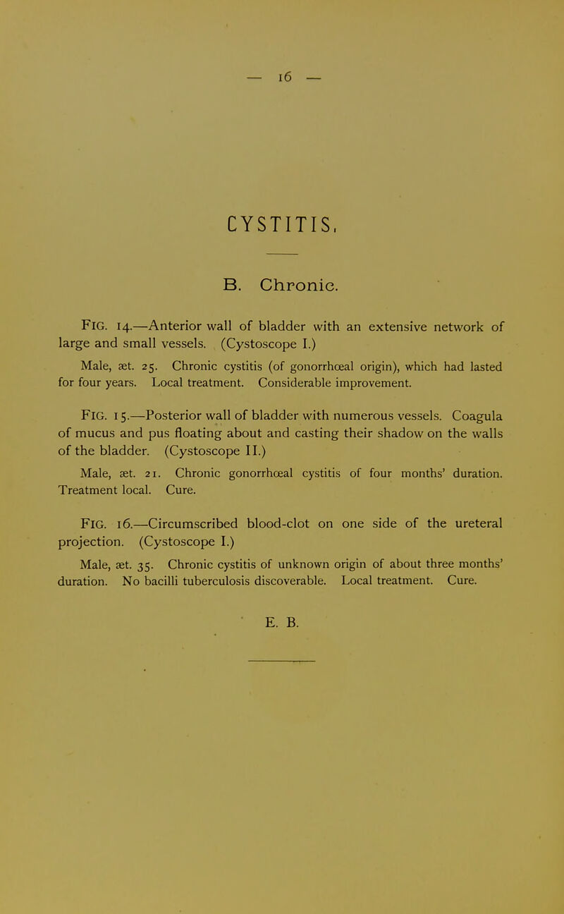 CYSTITIS. B. Chronic. Fig. 14.—Anterior wall of bladder with an extensive network of large and small vessels. (Cystoscope I.) Male, aet. 25. Chronic cystitis (of gonorrhoeal origin), which had lasted for four years. Local treatment. Considerable improvement. Fig. 15.—Posterior wall of bladder with numerous vessels. Coagula of mucus and pus floating about and casting their shadow on the walls of the bladder. (Cystoscope II.) Male, aet. 21. Chronic gonorrhoeal cystitis of four months' duration. Treatment local. Cure. Fig. 16.—Circumscribed blood-clot on one side of the ureteral projection. (Cystoscope I.) Male, aet. 35. Chronic cystitis of unknown origin of about three months' duration. No bacilli tuberculosis discoverable. Local treatment. Cure.