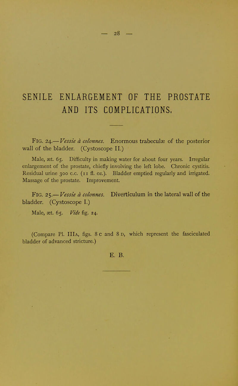 — 28 — SENILE ENLARGEMENT OF THE PROSTATE AND ITS COMPLICATIONS. Fig. 24.— Vessie d colonnes. Enormous trabeculae of the posterior wall of the bladder. (Cystoscope II.) Male, aet. 65. Difficulty in making water for about four years. Irregular enlargement of the prostate, chiefly involving the left lobe. Chronic cystitis. Residual urine 300 c.c. (11 fl. oz.). Bladder emptied regularly and irrigated. Massage of the prostate. Improvement. Fig. 25.— Vessie d colonnes. Diverticulum in the lateral wall of the bladder. (Cystoscope I.) Male, set. 65. Vide fig. 24. (Compare PI. IIIa, figs. 8 c and 8 d, which represent the fasciculated bladder of advanced stricture.)