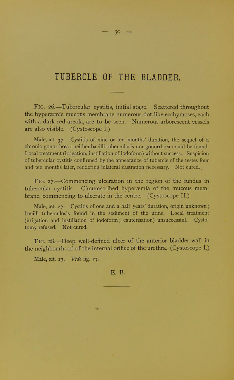Fig. 26.—Tubercular cystitis, initial stage. Scattered throughout the hyperaemic mucofis membrane numerous dot-like ecchymoses, each with a dark red areola, are to be seen. Numerous arborescent vessels are also visible. (Cystoscope I.) Male, set. 37. Cystitis of nine or ten months' duration, the sequel of a chronic gonorrhoea; neither bacilli tuberculosis nor gonorrhoea could be found. Local treatment (irrigation, instillation of iodoform) without success. Suspicion of tubercular cystitis confirmed by the appearance of tubercle of the testes four and ten months later, rendering bilateral castration necessary. Not cured. Fig. 27.—Commencing ulceration in the region of the fundus in tubercular cystitis. Circumscribed hyperaemia of the mucous mem- brane, commencing to ulcerate in the centre. (Cystoscope II.) Male, set. 27. Cystitis of one and a half years' duration, origin unknown; bacilli tuberculosis found in the sediment of the urine. Local treatment (irrigation and instillation of iodoform; cauterisation) unsuccessful. Cysto- tomy refused. Not cured. Fig. 28.—Deep, well-defined ulcer of the anterior bladder wall in the neighbourhood of the internal orifice of the urethra. (Cystoscope I.) Male, aet. 27. Vide fig. 27.