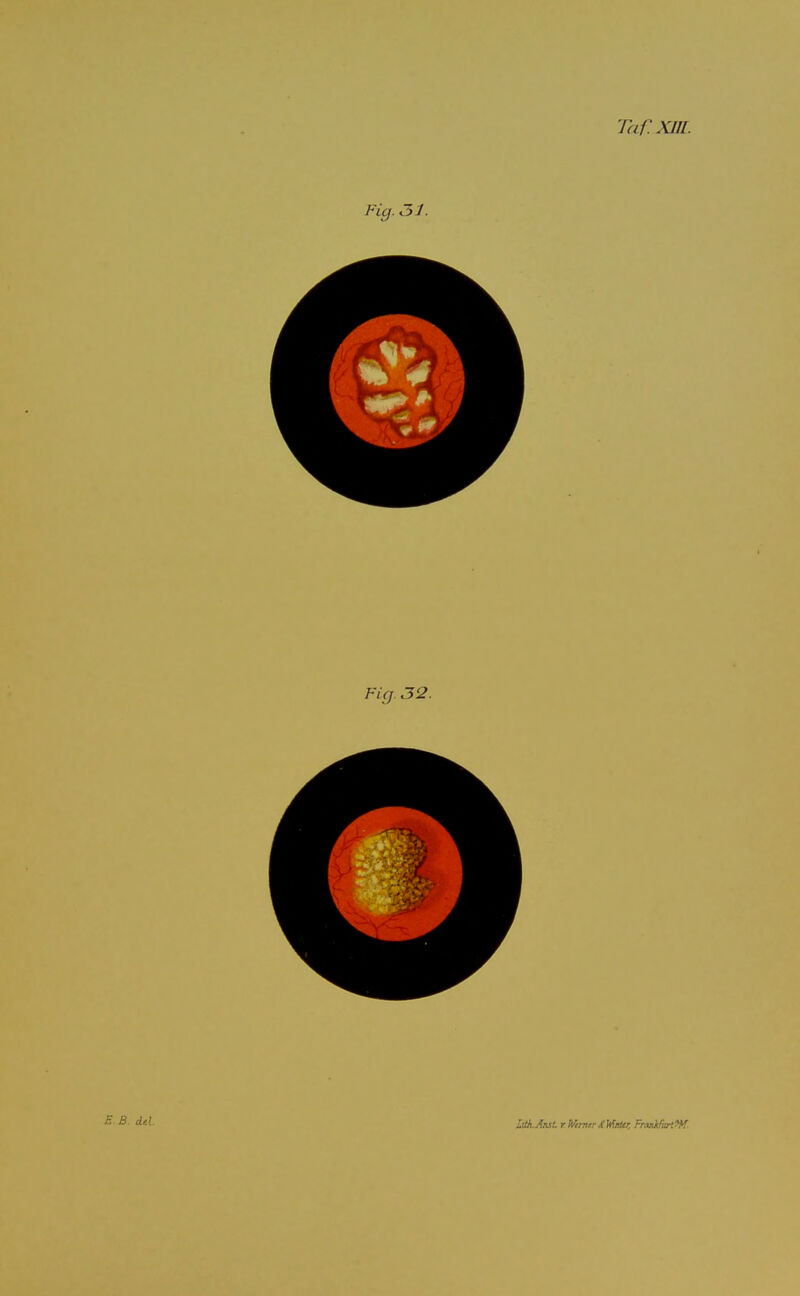 Taf.Xni. Fig. 31. lUkAnst r WmtrSVinUr, FraiMirtW