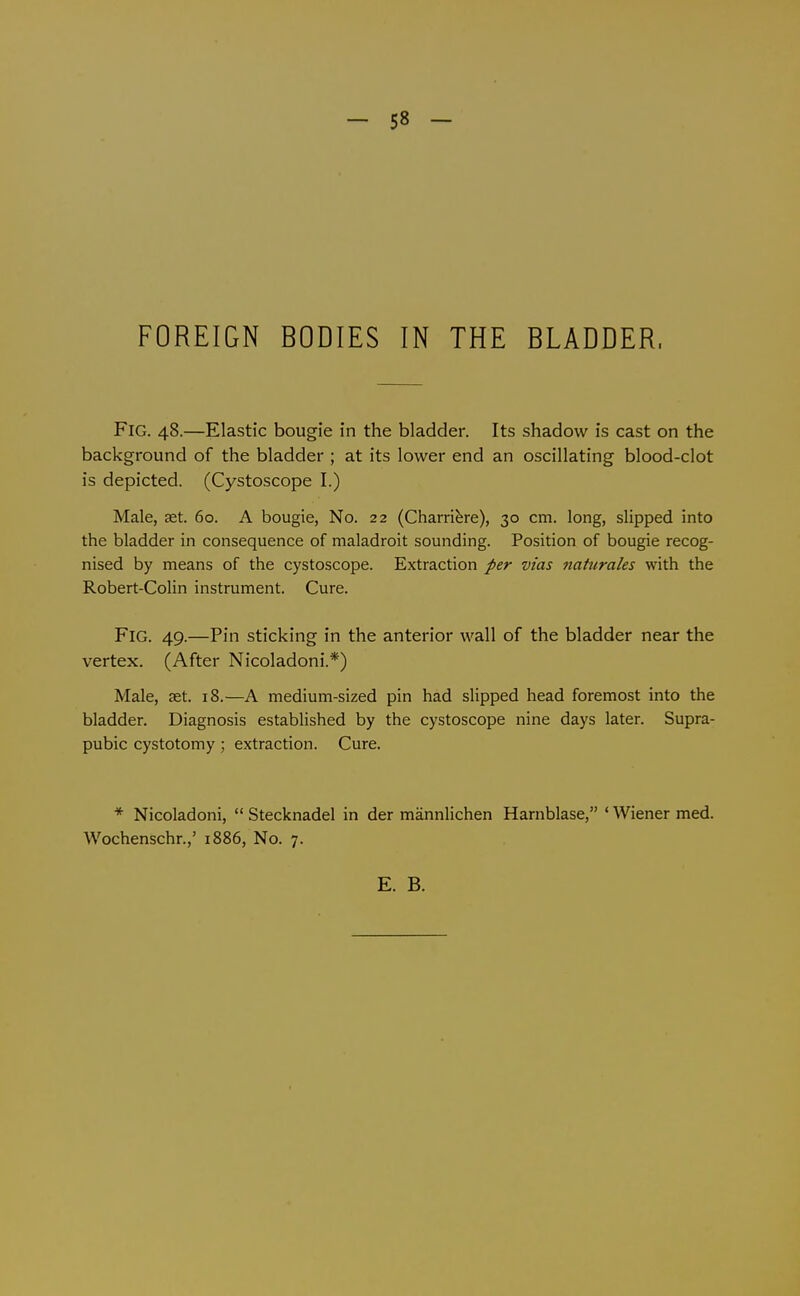 - 58 - FOREIGN BODIES IN THE BLADDER. Fig. 48.—Elastic bougie in the bladder. Its shadow is cast on the background of the bladder ; at its lower end an oscillating blood-clot is depicted. (Cystoscope I.) Male, set. 60. A bougie, No. 22 (Charri^re), 30 cm. long, slipped into the bladder in consequence of maladroit sounding. Position of bougie recog- nised by means of the cystoscope. Extraction per vias naturales with the Robert-Colin instrument. Cure. Fig. 49.—Pin sticking in the anterior wall of the bladder near the vertex. (After Nicoladoni.*) Male, set. 18.—A medium-sized pin had slipped head foremost into the bladder. Diagnosis established by the cystoscope nine days later. Supra- pubic cystotomy; extraction. Cure. * Nicoladoni,  Stecknadel in der mannlichen Harnblase, ' Wiener med. Wochenschr.,' 1886, No. 7.