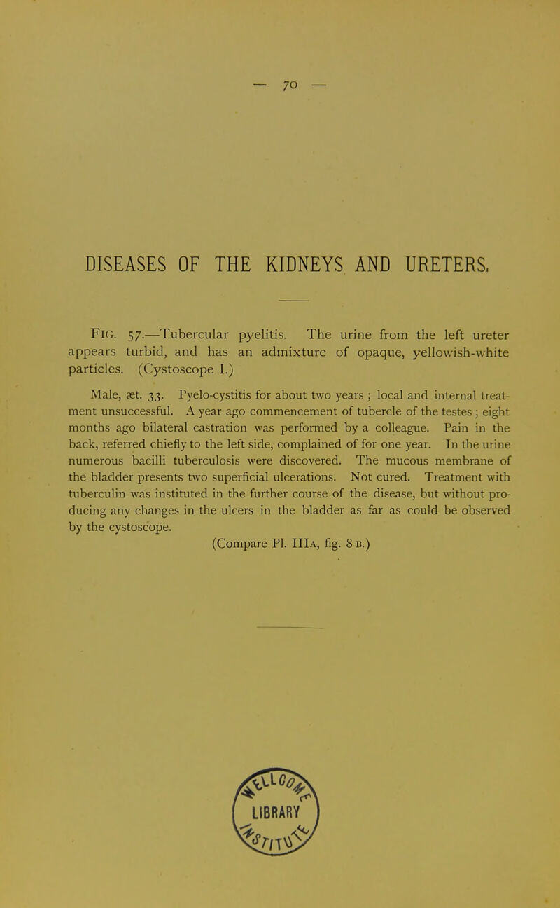 — 70 — DISEASES OF THE KIDNEYS AND URETERS. Fig. 57.—Tubercular pyelitis. The urine from the left ureter appears turbid, and has an admixture of opaque, yellowish-white particles. (Cystoscope I.) Male, ast. 33. Pyelo-cystitis for about two years ; local and internal treat- ment unsuccessful. A year ago commencement of tubercle of the testes; eight months ago bilateral castration was performed by a colleague. Pain in the back, referred chiefly to the left side, complained of for one year. In the urine numerous bacilli tuberculosis were discovered. The mucous membrane of the bladder presents two superficial ulcerations. Not cured. Treatment with tuberculin was instituted in the further course of the disease, but without pro- ducing any changes in the ulcers in the bladder as far as could be observed by the cystoscope. (Compare PI. IIIa, fig. 8 B.)