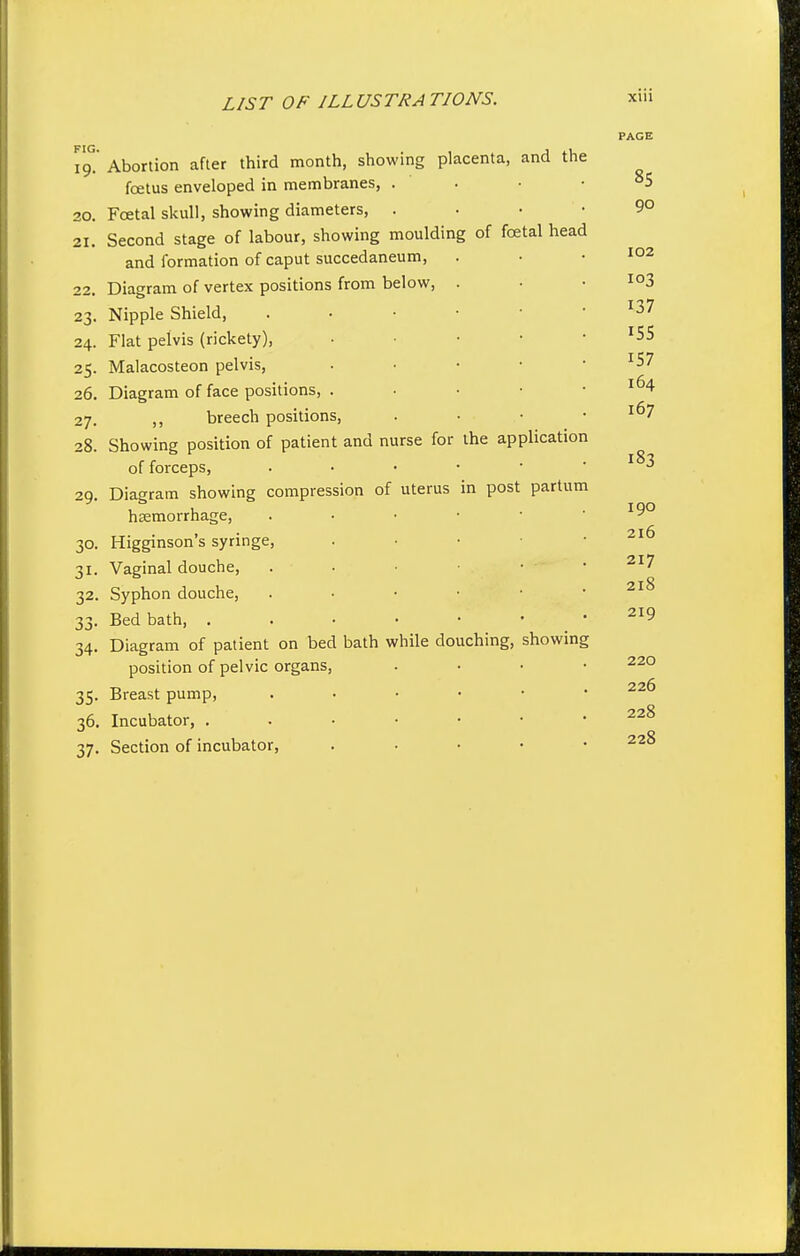 19!' Abortion after third month, showing placenta, and the foetus enveloped in membranes, . 20. Foetal skull, showing diameters, . 21. Second stage of labour, showing moulding of foetal head and formation of caput succedaneum, 22. Diagram of vertex positions from below, . 23. Nipple Shield, . • • • ■ 24. Flat pelvis (rickety), ■ • • • 25. Malacosteon pelvis, . • • • 26. Diagram of face positions, . • • • 27. ,, breech positions, 28. Showing position of patient and nurse for the application of forceps, . . . • ■ 29. Diagram showing compression of uterus in post partum hccmorrhage, . ■ • • • 30. Higginson's syringe, . • • • 31. Vaginal douche, 32. Syphon douche, . ■ • • • 33. Bed bath, 34. Diagram of patient on bed bath while douching, showin position of pelvic organs, 35. Breast pump, . . • • • 36. Incubator, 37. Section of incubator, . . • • PAGE