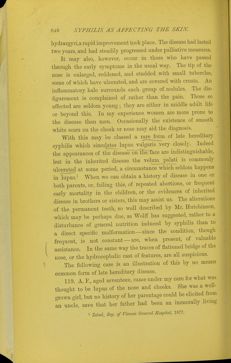 hydrargyria rapid improvement took place. The disease had lasted two years, and had steadily progressed under palliative measures. It may also, however, occur in those who have passed through the early symptoms in the usual way. The tip of the nose is enlarged, reddened, and studded with small tubercles, some of which have ulcerated, and are covered with crusts. An inflammatory halo surrounds each group of nodules. The dis- figurement is complained of rather than the pain. Those so affected are seldom young ; they are either in middle adult life or beyond this. In my experience women are more prone to the disease than men. Occasionally the existence of smooth white scars on the cheek or nose may aid the diagnosis. With this may be classed a rarejorm of late hereditary syphilis which simulates lupus vulgaris very closely. Indeed the appearances of the disease on tlie face are indistinguishable, but in the inherited disease the velum palati is commonly ulcerated at some period, a circumstance which seldom happens in lupus.1 When we can obtain a history of disease in one or both parents, or, failing this, of repeated abortions, or frequent early mortality in the children, or the evidences of inherited disease in brothers or sisters, this may assist us. The alterations of the permanent teeth, so well described by Mr. Hutchinson, which may be perhaps due, as Wolff has suggested, rather to a disturbance of general nutrition induced by syphilis than to a direct specific malformation—since the condition, though frequent, is not constant — are, when present, of valuable assistance. In the same way the traces of flattened bridge of the nose, or the hydrocephalic cast of features, are all suspicious. The following case is an illustration of this by no means common form of late hereditary disease. 119. A. F., aged seventeen, came under my care for what was thought to be' lupus of the nose and cheeks. She was a well- grown girl, but no history of her parentage could be elicited from an uncle, save that her father had been an immorally Hvmg 1 Zeissl, Re})- of Vienna General Hospital, 1877.