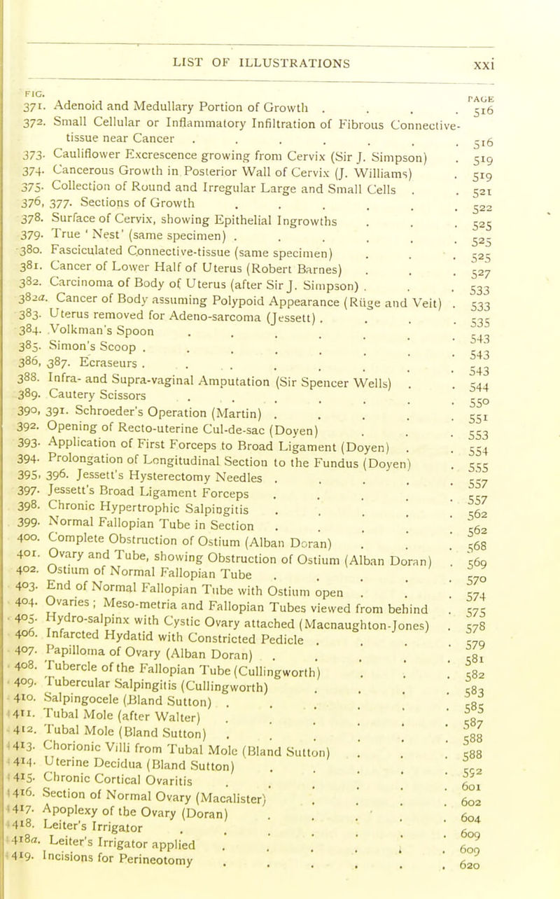 FIG. 37i- 372. 373- 374- 375- 376, 378. 379- •380. 381. 382. 382a 383- 384. 385. 386, 388. 389- 39°. 392- 393- 394- 395. 397- 398. 399- 400. 401. 402. 4°3- ■ 404. ■ 4°S- 406. 407. 408. 409. 410. 1411. 4<2. Hi3- ' 4*4- I4IS- (416. 4417- 1418. 418a ■419- Adenoid and Medullary Portion of Growth . Small Cellular or Inflammatory Infiltration of Fibrous Connective tissue near Cancer ..... Cauliflower Excrescence growing from Cervix (Sir J. Simpson) Cancerous Growth in Posterior Wall of Cervix (J. Williams Collection of Round and Irregular Large and Small Cells 377. Sections of Growth .... Surface of Cervix, showing Epithelial Ingrowths True ' Nest'(same specimen) .... Fasciculated Connective-tissue (same specimen) Cancer of Lower Half of Uterus (Robert Barnes) Carcinoma of Body of Uterus (after Sir J. Simpson) . Cancer of Body assuming Polypoid Appearance (Riige and Veit) Uterus removed for Adeno-sarcoma (Jessett) . Volkman's Spoon Simon's Scoop . 387. Ecraseurs . ... Infra- and Supra-vaginal Amputation (Sir Spencer Wells Cautery Scissors 391. Schroeder's Operation (Martin) . Opening of Recto-uterine Cul-de-sac (Doyen) Application of First Forceps to Broad Ligament (Doyen) Prolongation of Longitudinal Section to the Fundus (Doyen 396. Jessett's Hysterectomy Needles . Jessett's Broad Ligament Forceps Chronic Hypertrophic Salpingitis Normal Fallopian Tube in Section . Complete Obstruction of Ostium (Alban Doran) Ovary and Tube, showing Obstruction of Ostium (Alban Doran Ostium of Normal Fallopian Tube End of Normal Fallopian Tube with Ostium open Ovaries ; Meso-metria and Fallopian Tubes viewed from behind Hydro-salpinx with Cystic Ovary attached (Macnaughton-Jones) Infarcted Hydatid with Constricted Pedicle . Papilloma of Ovary (Alban Doran) Tubercle of the Fallopian Tube (Cullingworth) Tubercular Salpingitis (Cullingworth) Salpingocele (Bland Sutton) . Tubal Mole (after Walter) Tubal Mole (Bland Sutton) . \ Chorionic Villi from Tubal Mole (Bland Sutton) Uterine Decidua (Bland Sutton) Chronic Cortical Ovaritis Section of Normal Ovary (Macalister)' Apoplexy of the Ovary (Doran) Leiter's Irrigator Leiter's Irrigator applied Incisions for Perineotomy PAGE 5I<5