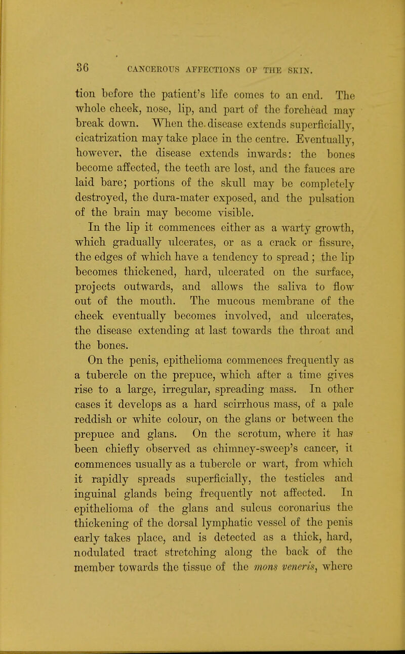 tion before the patient's life comes to an end. The whole cheek, nose, lip, and part of the forehead may break down. When the. disease extends superficially, cicatrization may take place in the centre. Eventually, however, the disease extends inwards: the bones become affected, the teeth are lost, and the fauces are laid bare; portions of the skull may be completely destroyed, the dura-mater exposed, and the pulsation of the brain may become visible. In the lip it commences either as a warty growth, which gradually ulcerates, or as a crack or fissure, the edges of which have a tendency to spread; the lip becomes thickened, hard, ulcerated on the surface, projects outwards, and allows the saliva to flow out of the mouth. The mucous membrane of the cheek eventually becomes involved, and ulcerates, the disease extending at last towards the throat and the bones. On the penis, epithelioma commences frequently as a tubercle on the prepuce, which after a time gives rise to a large, irregular, spreading mass. In other cases it develops as a hard scirrhous mass, of a pale reddish or white colour, on the glans or between the prepuce and glans. On the scrotum, where it hai? been chiefly observed as chimney-sweep's cancer, it commences usually as a tubercle or wart, fi-om which it rapidly spreads superficially, the testicles and inguinal glands being frequently not affected. In epithelioma of the glans and sulcus coronarius the thickening of the dorsal lymphatic vessel of the penis early takes place, and is detected as a thick, hard, nodulated tract stretching along the back of the member towards the tissue of the mons veneris, where