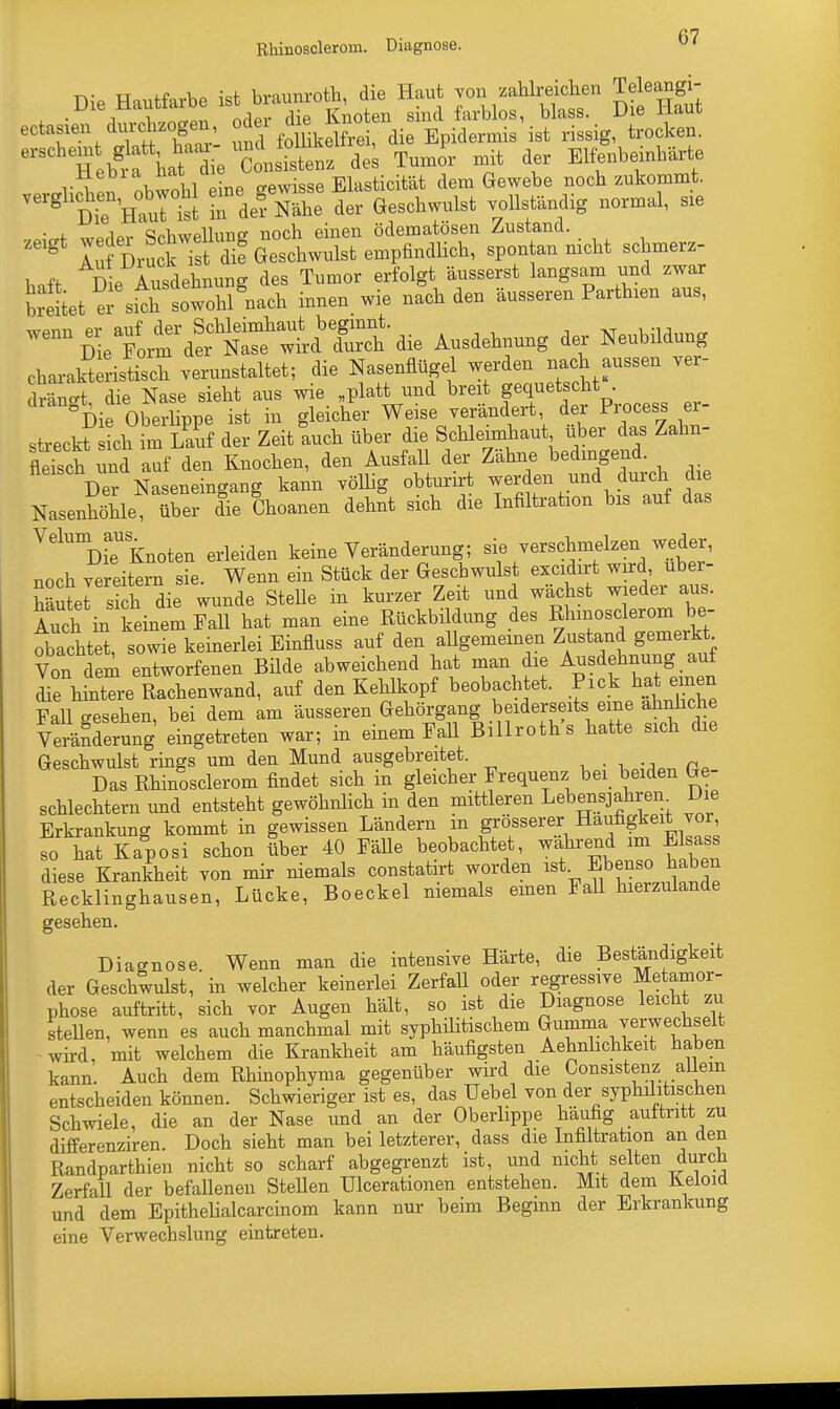 an Rhinoscleroui. Diagnose. Die Hautfarbe ist braunroth, die Haut JOB zar^eicken Teleangi- ■ i „1 „„„0n nrlpv die Knoten sind farblos, blass. JJie riaut ectasxen dmxl zogen oder ^ ^ ^ ^ ^ trocken. 1 HebSra bat die clsistenz des Tumor mit der Elfenbemhärte r i iwnhl eine gewisse Elasticität dem Gewebe nocb zukommt, verghcben^obwobl JM^ ^ uf dig normal, sie • l d^iwAllimc- noch einen ödematösen Zustand. Zeigt I^rS^G^wubt empfindlich, spontan nicbt schmerz- haft Die Ausdehnung des Tumor erfolgt äusserst langsam und zwar Wet er skh sowohl nach innen wie nach den äusseren Partinen aus, WennDieaFform aSÄaie Ausdehnung der Neubildung charakl istisch verunstaltet; die Nasenflügel werden nach aussen ver- dräng die Nase sieht aus wie „platt und breit gequetscht Die Oberlippe ist in gleicher Weise verändert der Process er- streckt ch im Lauf der Zeit auch über die Schlennhaut über das Zahn- fleisch und auf den Knochen, den Ausfall der Zähne bedingend. Der Naseneingang kann völlig obturirt werden und durch die NasenhöHe über d°ie Choanen dehnt sich die Infiltration bis auf das VelUmDiaeU Knoten erleiden keine Veränderung; sie verschmelzen weder, noch vereitern sie. Wenn ein Stück der Geschwulst excidirt wird, uber- äSet rieh die wunde Stehe in kurzer Zeit und wächst wieder aus. Auch m keinem Fall hat man eine Rückbildung des Rhmosclerom be- dachtet, sowie keinerlei Einfluss auf den allgemeinen Zustand gemerkt. Von dem entworfenen Bilde abweichend hat man die Ausdehnung auf die hintere Rachenwand, auf den Kehlkopf beobachtet. Pick hat einen Fall gesehen, bei dem am äusseren Gehörgang beiderseits eine ähnliche VeräSerung eingetreten war; in einem Fall Billroth's hatte sich die Geschwulst rings um den Mund ausgebreitet. . Das Rhinosclerom findet sich in gleicher Frequenz bei beiden Ge- schlechtern und entsteht gewöhnlich in den mittleren Lebensjahren Die Erkrankung kommt in gewissen Ländern m grösserer Häufigkeit vor, fo hat Kaposi schon über 40 Fälle beobachtet, während im Elsass diese Krankheit von mir niemals constatirt worden ist Ebenso haben Recklinghausen, Lücke, Boeckel niemals einen Fall hierzulande gesehen. Diagnose. Wenn man die intensive Härte, die Beständigkeit der Geschwulst, in welcher keinerlei Zerfall oder regressive Metamor- phose auftritt, sich vor Augen hält, so ist die Diagnose leicht zu stellen, wenn es auch manchmal mit syphilitischem Gumma verwechselt wird, mit welchem die Krankheit am häufigsten Aehnlichkeit haben kann. Auch dem Rhinophyma gegenüber wird die Consistenz; allein entscheiden können. Schwieriger ist es, das Uebel von der sypliditischen Schwiele, die an der Nase und an der Oberlippe häufig auttritt zu differenziren. Doch sieht man bei letzterer, dass die Infiltration an den Randparthien nicht so scharf abgegrenzt ist, und nicht selten durch Zerfall der befallenen Stellen ülcerationen entstehen. Mit dem Keloid und dem Epithelialcarcinom kann nur beim Beginn der Erkrankung eine Verwechslung eintreten.