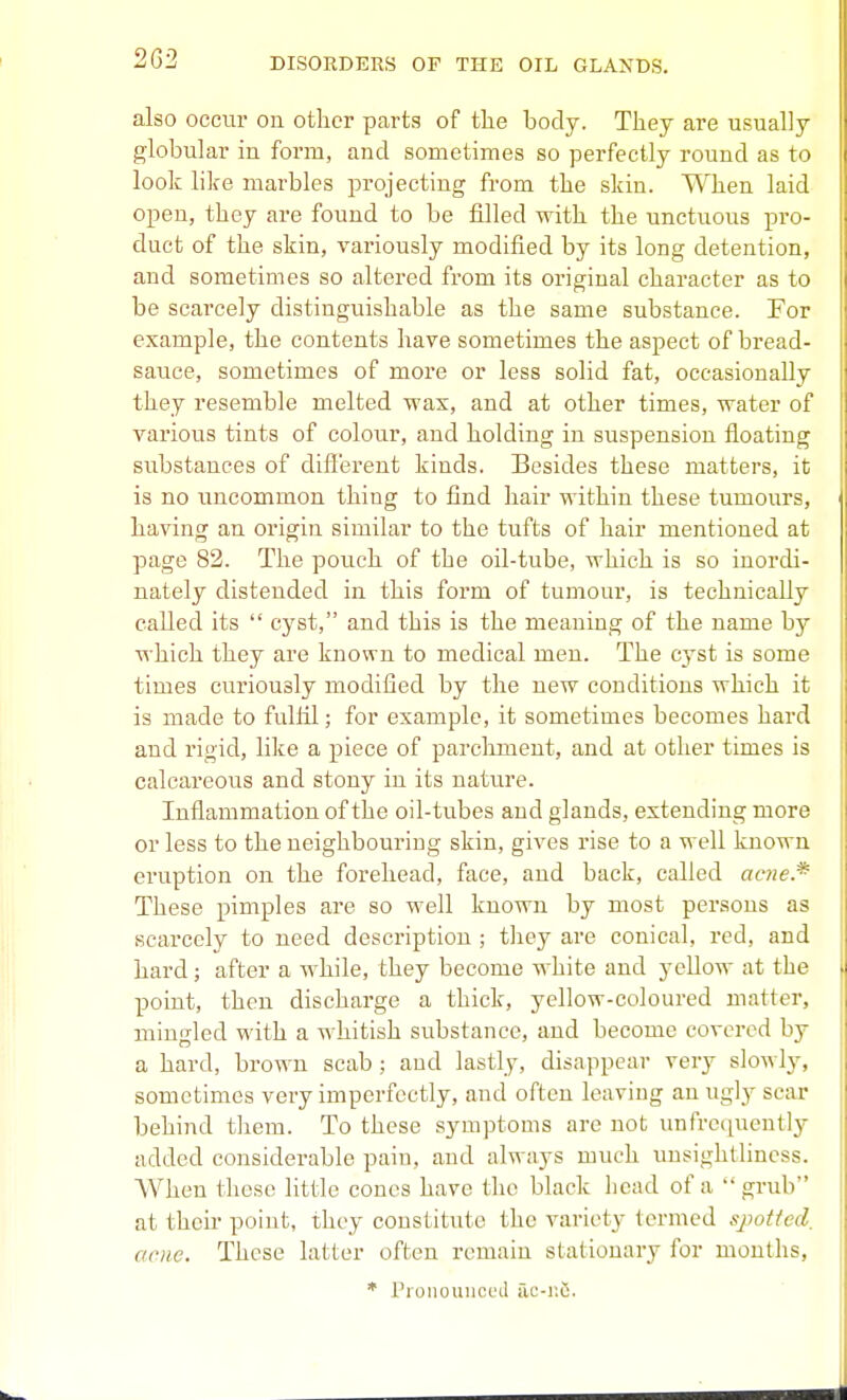 also occur on other parts of the body. They are usually globular in form, and sometimes so perfectly round as to look like marbles projecting from the skin. When laid open, they are found to be filled with the unctuous pro- duct of the skin, variously modified by its long detention, and sometimes so altered from its original character as to be scarcely distinguishable as the same substance. For example, the contents have sometimes the aspect of bread- sauce, sometimes of more or less solid fat, occasionally they resemble melted wax, and at other times, water of various tints of colour, and holding in suspension floating substances of diflerent kinds. Besides these matters, it is no uncommon thing to find hair within these tumours, having an origin similar to the tufts of hair mentioned at page 82. The pouch of the oil-tube, which is so inordi- nately distended in this form of tumour, is technically called its  cyst, and this is the meaning of the name by which they are known to medical men. The cyst is some times curiously modified by the new conditions which it is made to fulfil; for example, it sometimes becomes hard and rigid, like a piece of parchment, and at other times is calcareous and stony in its nature. Inflammation of the oil-tubes and glands, extending more or less to the neighbouring skin, gives rise to a well known eruption on the forehead, face, and back, called acne.* These pimples are so well known by most persons as scarcely to need description ; they are conical, red, and hard; after a while, they become white and yellow at the point, then discharge a thick, yellow-coloured matter, mingled with a whitish substance, and become covered by a hard, brown scab; and lastly, disappear very slowly, sometimes very imperfectly, and often leaving an ugly scar behind them. To these symptoms are not unfrequently added considerable pain, and always much unsightlincss. When these little cones have the black liead of a grub at then- point, they constitute the variety termed spotted, acne. These latter often remain stationary for months, * I'lonouiictHl ac-i;6.