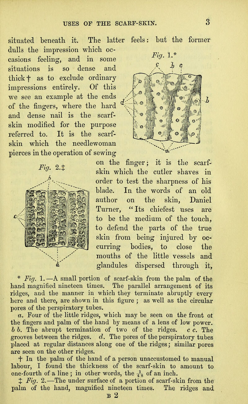 Fig. 1.* situated beneath it. The latter feels; but the former dulls the impression which oc- casions feeling, and in some situations is so dense and thick t as to exclude ordinary impressions entirely. Of this we see an example at the ends of the fingers, where the hard and dense nail is the scarf- skin modified for the purpose referred to. It is the scarf- skin which the needlewoman pierces in the operation of sewing on the finger: it is the scarf- skin which the cutler shaves in order to test the sharpness of his blade. In the words of an old author on the skin, Daniel Turner, Its chiefest uses are to be the medium of the touch, to defend the parts of the true skin from being injured by oc- curring bodies, to close the mouths of the little vessels and glandules dispersed through it. * Fig. 1.—A small portion of scarf-skin from the palm of the hand magnified nineteen times. The parallel arrangement of its ridges, and the manner in which they terminate abruptly every here and there, are shown in this figure ; as well as the circular pores of the perspiratory tubes. a. Four of the little ridges, which may be seen on the front ot the fingers and palm of the hand by means of a lens of low power. hh. The abrupt termination of two of the ridges. c c. The grooves between the ridges, d. The pores of the perspiratory tubes placed at regular distances along one of the ridges; similar pores are seen on the other ridges. f In the palm of the hand of a person unaccustomed to manual labour, I found the thickness of the scarf-skin to amount to one-fourth of a line ; in other words, the of an inch. J Fig. 2,—The under surface of a portion of scarf-skin from the palm of the hand, magnified nineteen times. The ridges and B 2