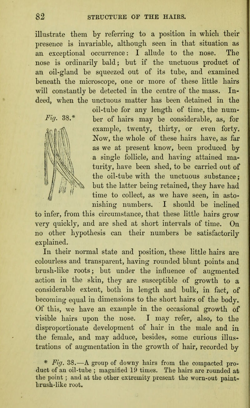 illustrate them by referring to a position in wbicli their presence is invariable, although seen in that situation as an exceptional occurrence: I allude to the nose. The nose is ordinarily bald; but if the unctuous product of an oil-gland be squeezed out of its tube, and examined beneath the microscope, one or more of these little hairs will constantly be detected in the centre of the mass. In- deed, when the unctuous matter has been detained in the oil-tube for any length of time, the num- Fig. 38.* ber of hairs may be considerable, as, for example, twenty, thirty, or even forty. Now, the whole of these hairs have, as far as we at present know, been produced by a single follicle, and having attained ma- turity, have been shed, to be carried out of the oil-tube with the unctuous substance; but the latter being retained, they have had time to collect, as we have seen, in asto- nishing numbers. I should be inclined to infer, from this circumstance, that these little hairs grow very quickly, and are shed at short intervals of time. On no other hypothesis can their numbers be satisfactorily explained. In their normal state and position, these little hairs are colourless and transparent, having rounded blunt points and brush-like roots; but under the influence of augmented action in the skin, they are susceptible of growth to a considerable extent, both in length and bulk, in fact, of becoming equal in dimensions to the short hairs of the body. Of this, we have an example in the occasional growth of visible hairs upon the nose. I may refer, also, to the disproportionate development of hair in the male and in the female, and may adduce, besides, some curious illus- trations of augmentation in the growth of hair, recorded by * Fig. 38.—A group of downy hairs from the compacted pro- duct of an oil-tube ; magnified 19 times. The hairs are rounded at the point; and at the other extremity present the worn-out paint- brush-like root.