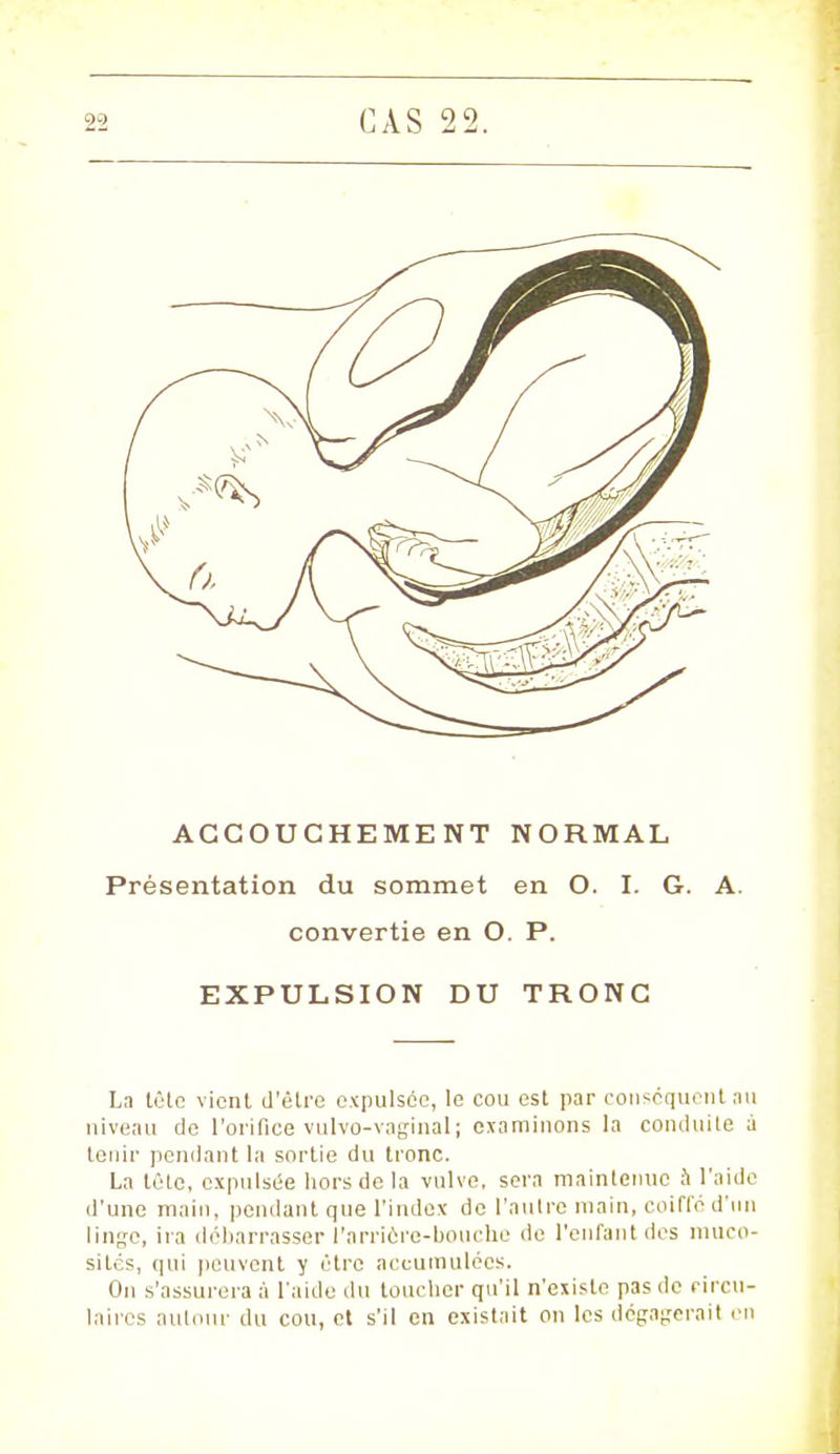 ACCOUCHEMENT NORMAL Présentation du sommet en O. I. G. A. convertie en O. P. EXPULSION DU TRONC Ln tête vient d'être expulsée, le cou est par conséquent au niveau de l'orifice vulvo-vaginal ; examinons la conduite à tenir pendant la sortie du tronc. La tête, expulsée hors de la vulve, sera maintenue à l'aide d'une main, pendant que l'index de l'autre main, coiffé d'un linge, ira débarrasser l'amcre-bouche de l'enfant des muco- sités, qui peuvent y être accumulées. On s'assurera à l'aide du loucher qu'il n'existe pas de circu- laires autour du cou, et s'il en existait on les dégagerait en