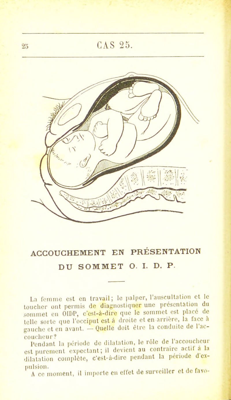 ACCOUCHEMENT EN PRÉSENTATION DU SOMMET O. I. D. P. La femme est en travail; le palper, l'auscultation et le toucher ont permis de diagnostiquer une présentation du sommet en OIDP, c'est-à-dire que le sommet est place de telle sorte que l'occiput est à droite et en arrière, la l'ace à gauche et en avant. - Quelle doit être la conduite de l'ac- coucheur? , ,, , Pendant la période de dilatation, le rôle de 1 accoucheur est purement expectant; il devient au contraire actif a la dilatation complète, c'est-à-dire pendant la période d ex- pulsion. .,, . , f A ce moment, il importe en effet de surveiller et de favo-