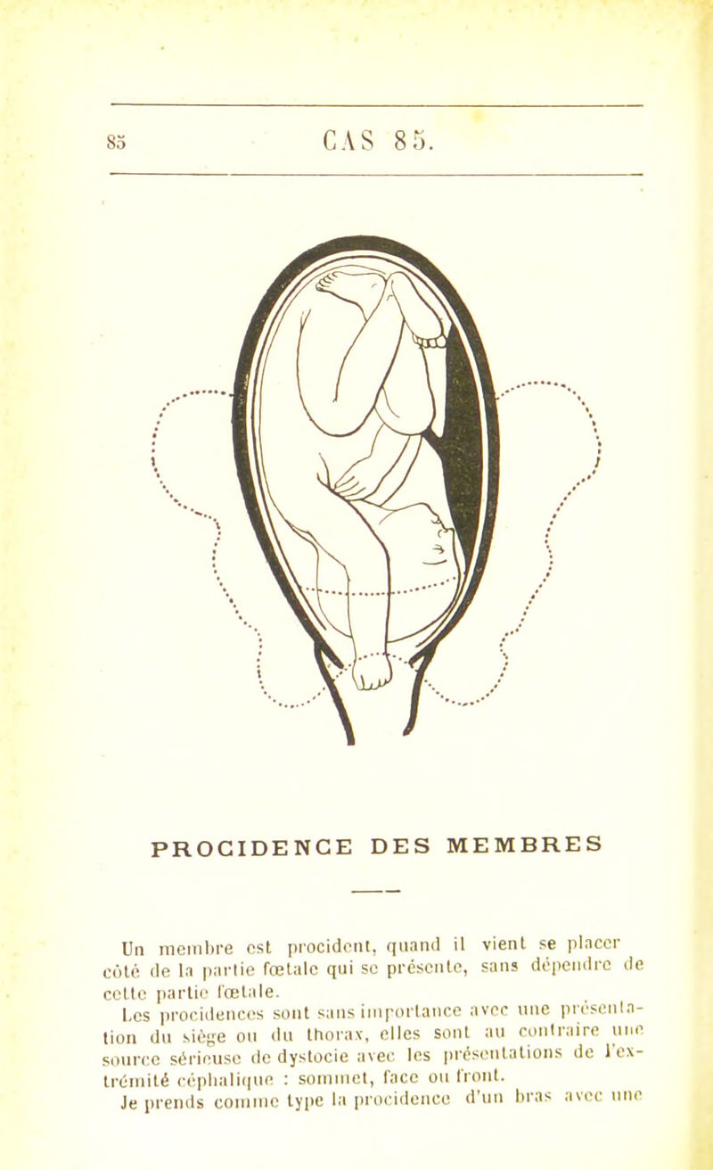 PROCIDENCE DES MEMBRES Un membre est procidcnt, quand il vient se placer eoté de la partie fœtale qui se présente, sans dépendre de cette partie fœtale. Les procidences sont sans importance avec une présent n- tion du .siège ou du thorax, elles sont au contraire une source sérieuse de dystocie avec les présentations de l'ex- trémité céphalique : sommet, face ou front. Je prends comme type la procidenco d'un liras avec une