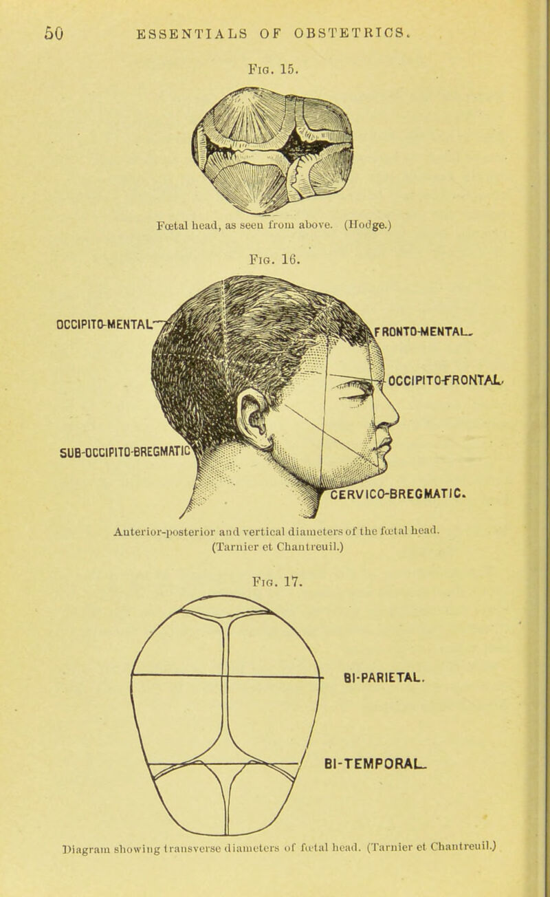 Fig. 15. Foetal head, as seen from above. (Hotlge.) Fig. 16. Anterior-posterior and vertical diameters of the festal head. (Tarnier et Chantreuil.) Fig. 17. BI-PARIETAL. BI-TEMPORAL. Diagram showing transverse diameters of foetal head. (Tarnier et Chantreuil.)