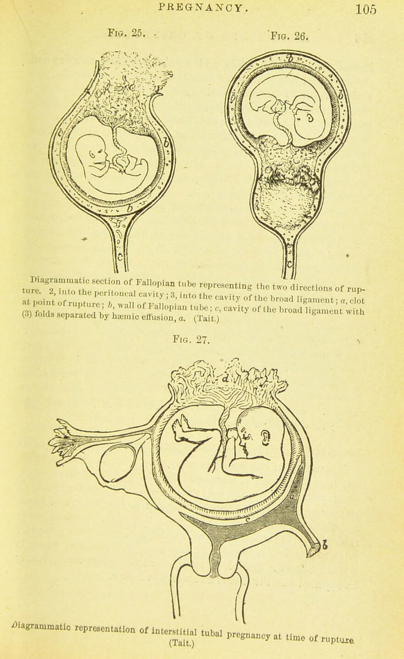 Fig. 25. Fig. 26. u^%72al7CtT °f ,Fal]°Pian tUbe -—ting the two directions of rup- (3) folds separ^ Vn^ c°S^ °f ^ ^ ^ Fig. 27.