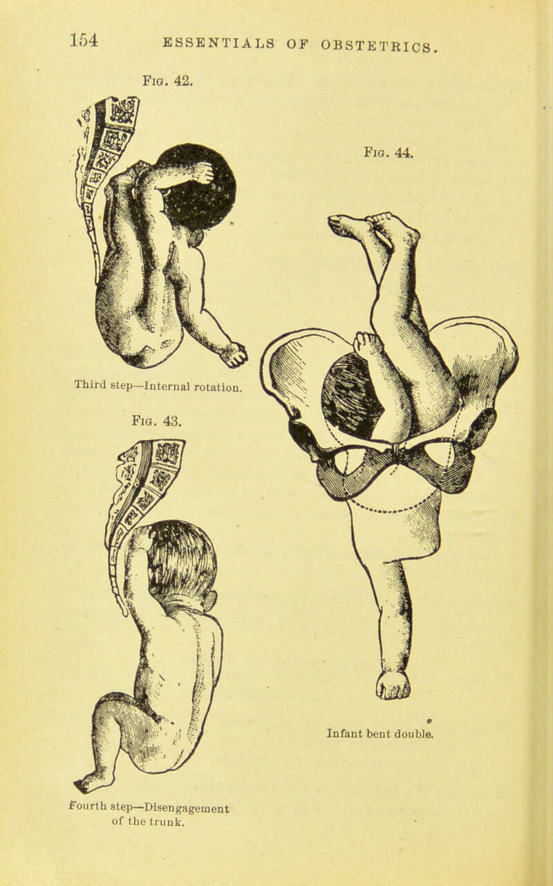Fig. 42. Fourth step—Disengagement of the trunk.