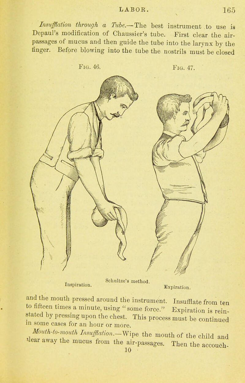 Insufflation through a Tube.-— The best instrument to use is Depaul's modification of Chaussier's tube. First clear the air- passages of mucus and then guide the tube into the larynx by the finger. Before blowing into the tube the nostrils must be closed Fig. 46. Fig. 47. Inspiration. Schultze's method. Expiration. and the mouth pressed around the instrument. Insufflate from ten to fifteen times a minute, using  some force. Expiration is rein- stated by pressing upon the chest. This process must be continued in some cases for an hour or more. Mouth-to-mouth Insufflation.-Wipe the mouth of the child and *lear away the mucus from the air-passages. Then the accouch- 10 •
