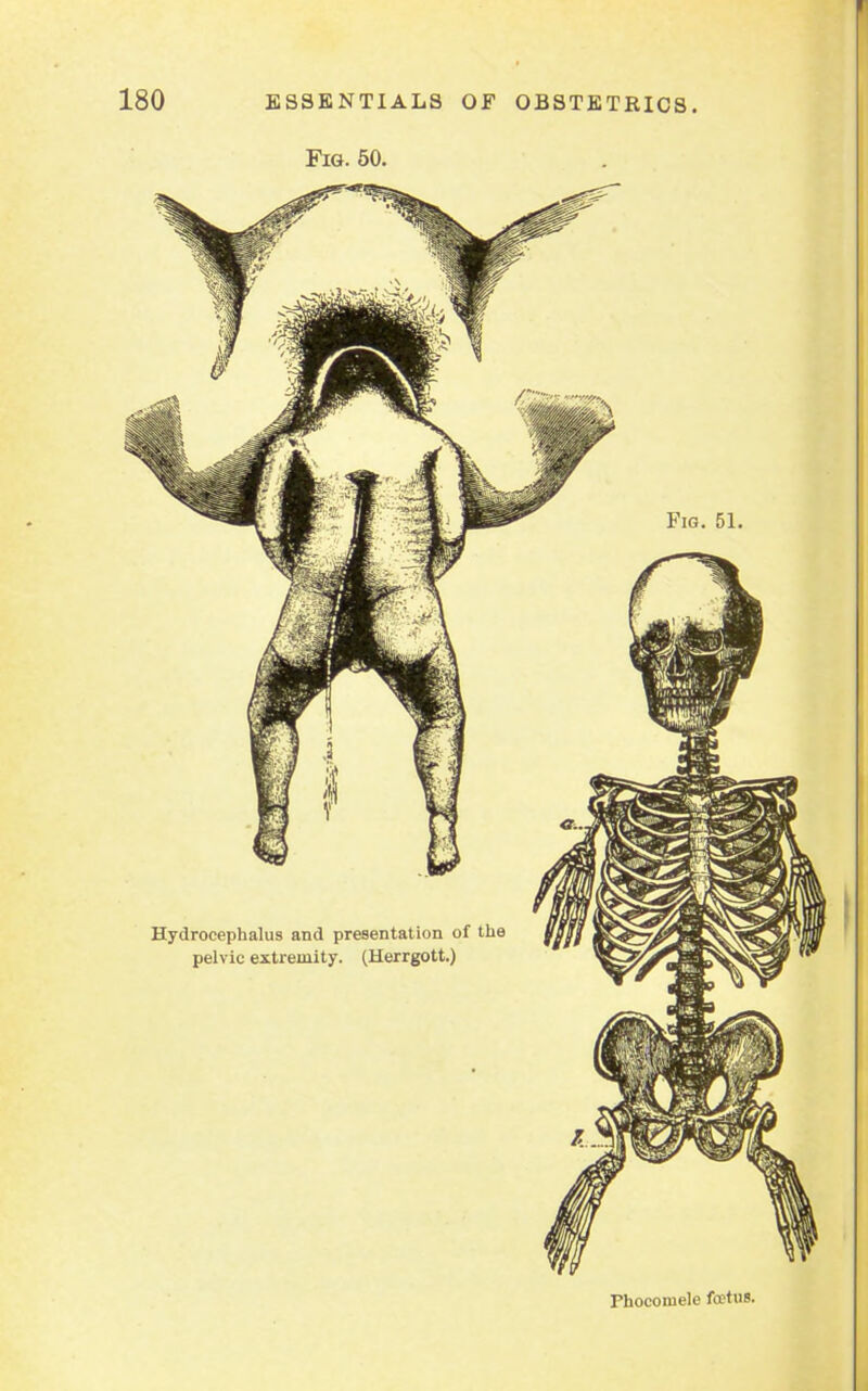 Fig. 50. Phocoruele foetus