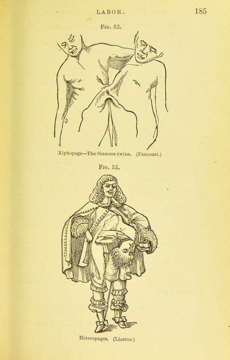 Fig. 52. Heteropages. (Licetus.)