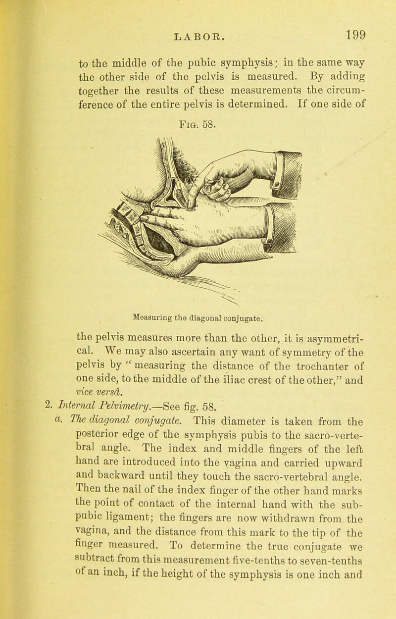 to the middle of the pubic symphysis; in the same way the other side of the pelvis is measured. By adding together the results of these measurements the circum- ference of the entire pelvis is determined. If one side of the pelvis measures more than the other, it is asymmetri- cal. We may also ascertain any want of symmetry of the pelvis by  measuring the distance of the trochanter of one side, to the middle of the iliac crest of the other, and vice versd. 2. Internal Pelvimetry.—See fig. 58. a. The diagonal conjugate. This diameter is taken from the posterior edge of the symphysis pubis to the sacro-verte- bral angle. The index and middle fingers of the left hand are introduced into the vagina and carried upward and backward until they touch the sacro-vertebral angle. Then the nail of the index finger of the other hand marks the point of contact of the internal hand with the sub- pubic ligament; the fingers are now withdrawn from the vagina, and the distance from this mark to the tip of the finger measured. To determine the true conjugate we subtract from this measurement five-tenths to seven-tenths of an inch, if the height of the symphysis is one inch and Fig. 58. Measuring the diagonal conjugate.