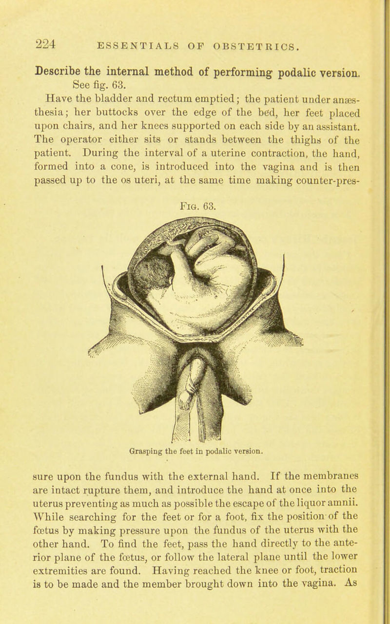 Describe the internal method of performing podalic version. See fig. 63. Have the bladder and rectum emptied; the patient under anaes- thesia; her buttocks over the edge of the bed, her feet placed upon chairs, and her knees supported on each side by an assistant. The operator either sits or stands between the thighs of the patient. During the interval of a uterine contraction, the hand, formed into a cone, is introduced into the vagina and is then passed up to the os uteri, at the same time making counter-pres- Fig. 63. Grasping the feet in podalic version. sure upon the fundus with the external hand. If the membranes are intact rupture them, and introduce the hand at once into the uterus preventing as much as possible the escape of the liquor amnii. While searching for the feet or for a foot, fix the position of the foetus by making pressure upon the fundus of the uterus with the other hand. To find the feet, pass the hand directly to the ante- rior plane of the foetus, or follow the lateral plane until the lower extremities are found. Having reached the knee or foot, traction is to be made and the member brought down into the vagina. As