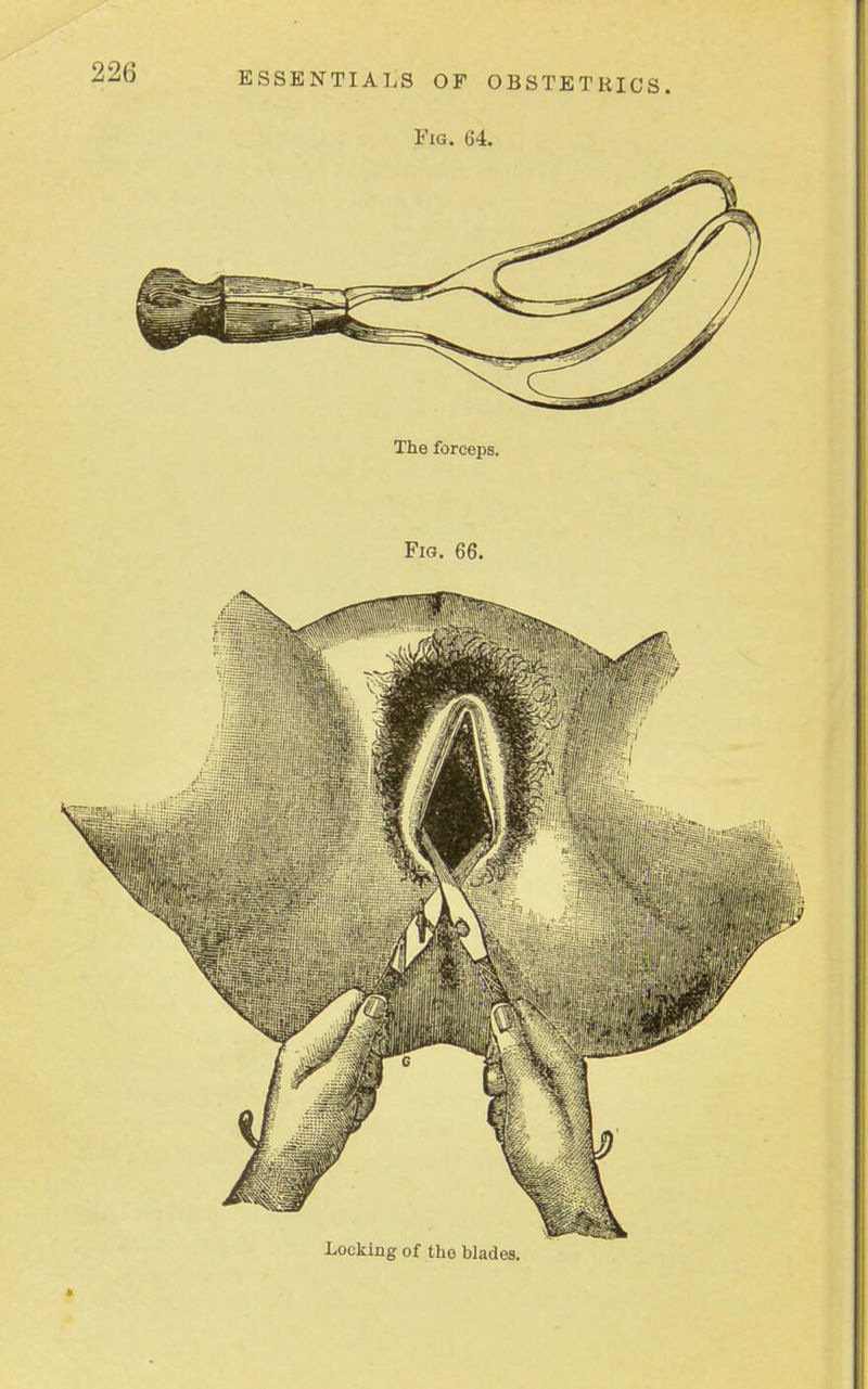 2±> Fig. 64. The forceps.