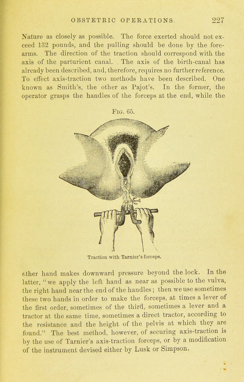 Nature as closely as possible. The force exerted should not ex- ceed 132 pounds, and the pulling should be done by the fore- arms. The direction of the traction should correspond with the axis of the parturient canal. . The axis of the birth-canal has already been described, and, therefore, requires no further reference. To effect axis-traction two methods have been described. One known as Smith's, the other as Pajot's. In the former, the operator grasps the handles of the forceps at the end, while the Fig. 65. Traction with Tarnier's forceps. ether hand makes downward pressure beyond the lock. In the latter, we apply the left hand as near as possible to the vulva, the right hand near the end of the handles; then we use sometimes these two hands in order to make the forceps, at times a lever of the first order, sometimes of the third, sometimes a lever and a tractor at the same time, sometimes a direct tractor, according to the resistance and the height of the pelvis at which they are found. The best method, however, of securing axis-traction is by the use of Tarnier's axis-traction forceps, or by a modification of the instrument devised either by Lusk or Simpson.