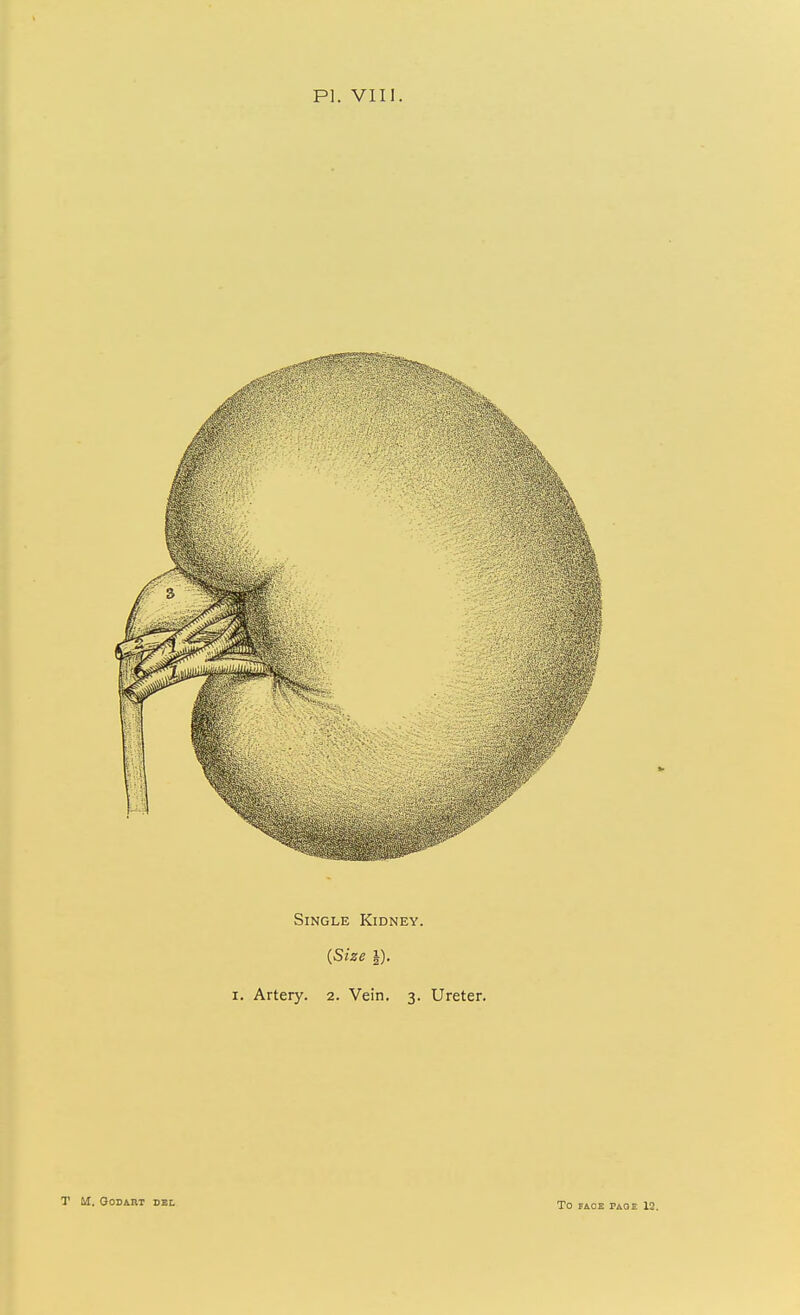 Single Kidney. {Size 1). I. Artery. 2. Vein. 3. Ureter.