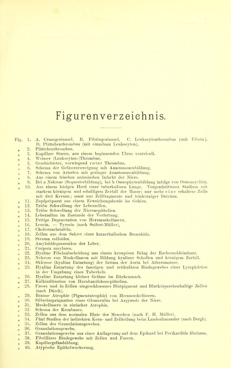 Figuren Verzeichnis. Fig. 1. A. Cruorgerinnsel. B. Fibringerinnsel. C. Leukocytenthrombus (mit Fibrin). D. Plättchenthrombiis (mit einzelnen Leukocytenj. 2. Plättcheuthrombus. ^ 3. Kapillare Stasen, aus einem beginnenden Ulcus ventriouli. „ 4. Weisser (Leukocyten-)Thrombus. „ 5. Geschichteter, vorwiegend roter Thrombus. „ 6. Schema der Gefässverzweigung mit Anastomosenbildung. „ 7. Schema von Arterien mit geringer Anastomosenbildung. „ 8. Aus einem frischen anämischen Infarkt der Niere. „ 9. Bei a Nekrose (Sequesterbildung), bei b Osteophytenbildung infolge von Osteomyelitis. 3, 10. Aus einem käsigen Herd einer tuberkulösen Lunge. Vorgeschrittenes Stadium mit starkem körnigem und scholligem Zerfall der Masse; nur mehr eine erhaltene Zelle mit drei Kernen; sonst nur Zellfragmente und feinkörniger Detritus. ^ 11. Zupfpräparat aus einem Erweichungsherde im Gehirn. „ 12. Trübe Schwellung der Leberzellen. „ 13. Trübe Schwellung der Nierenepithelien. „ 14. Leberzellen im Zustande der Verfettung. „ 15. Fettige Degeneration von Herzmuskelfasern. „ 16. Leucin. — Tyrosin (nach Seifert-Müller). „ 17. Cholestearintafein. „ 18. Zellen aus dem Sekret einer katarrhalischen Bronchitis, „ 19. Struma colloides. „ 20. Amyloiddegeneration der Leber. „ 21. Corpora amylacea. „ 22. Hyaline Fibrinabscheidung aus einem kroupösen Belag der Rachenschleimhaut. „ 23. Nekrose von Muskelfasern mit Bildung hyaliner Schollen und körnigem Zerfall. „ 24. Sklerose (hyaline Entartung) der Intima der Aorta bei Atheromatose. „ 25. Hyaline Entartung des faserigen und retikulären Bindegewebes einer Lymphdrüse in der Umgebung eines Tuberkels. „ 26. Hyaline Entartung kleiner Gefässe im Rückenmark. „ 27. Kalkinfiltration von Harnkanälcheuepitlielien. „ 28. Freies und- in Zellen eingeschlossenes Blutpigment und Blutkörperchenhaltige Zöllen (nach Dürck). Braune Atrophie (Pigmentatrophie) von Herzmuskelfasern. 30. Silberimprägnation eines Glomerulus bei Argyrosis der Niere. 31. Muskelfasern in einfacher Atrophie. 32. Schema des Kernbaues. 33. Zellen aus dem normalen Blute des Menschen (nach F. H. Müller). 34. Fünf Stadien der indirekten Kern- und Zellteilung beim Landsalamander (nach Bergh). 35. Zellen des Granulationsgewebes. 36. Granulationsgewebe. 37. Granulationsgewebe aus einer Auflagerung auf dem Epikard bei Perikarditis fibrinosa. 38. Fibrilläres Bindegewebe mit Zellen und Fasern. 39. Kapillargefässbildung. 40. Atypische Epithelwucherung. 9(