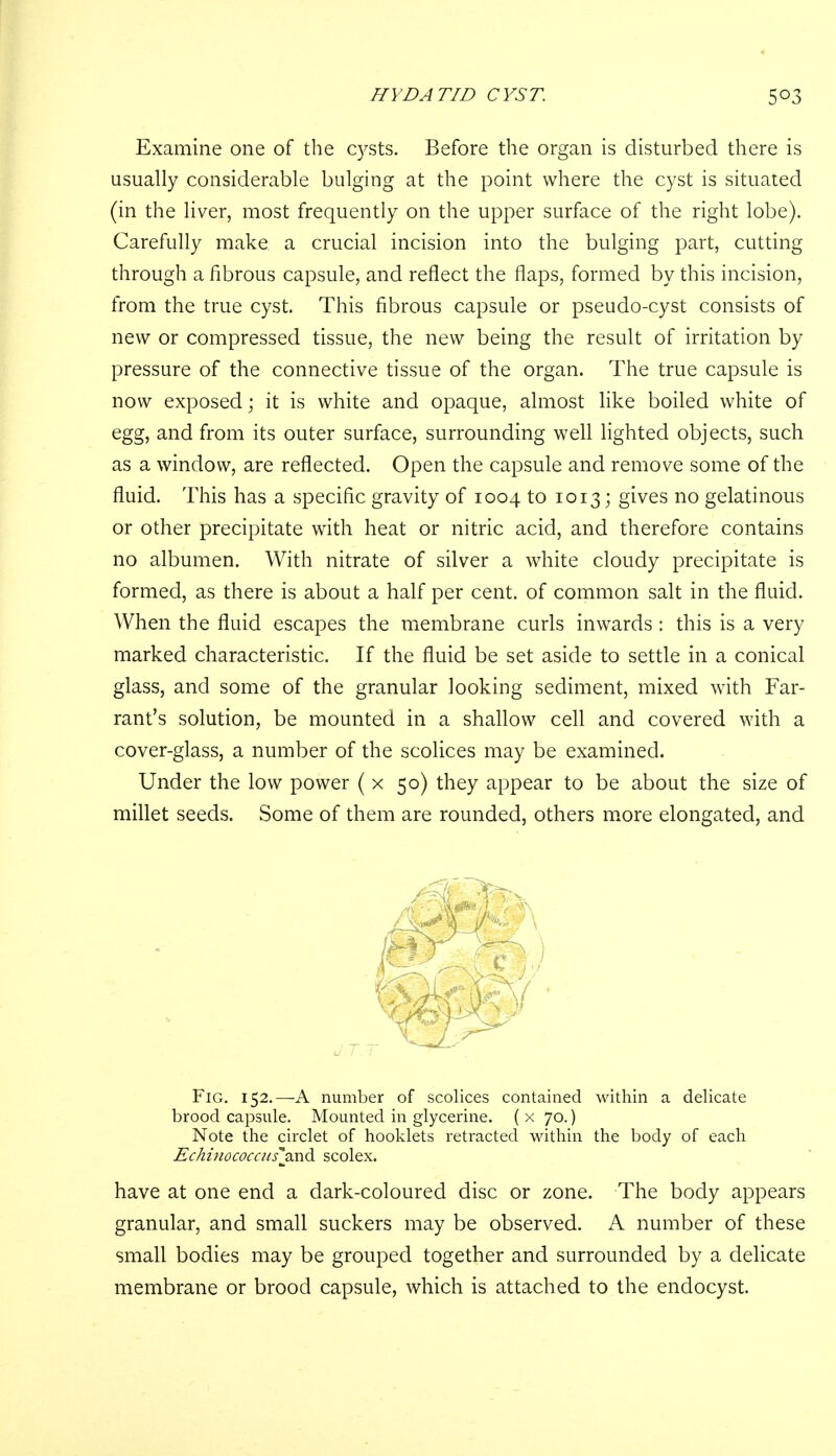 Examine one of the cysts. Before the organ is disturbed there is usually considerable bulging at the point where the cyst is situated (in the liver, most frequently on the upper surface of the right lobe). Carefully make a crucial incision into the bulging part, cutting through a fibrous capsule, and reflect the flaps, formed by this incision, from the true cyst. This fibrous capsule or pseudo-cyst consists of new or compressed tissue, the new being the result of irritation by pressure of the connective tissue of the organ. The true capsule is now exposed; it is white and opaque, almost like boiled white of egg, and from its outer surface, surrounding well lighted objects, such as a window, are reflected. Open the capsule and remove some of the fluid. This has a specific gravity of 1004 to 1013; gives no gelatinous or other precipitate with heat or nitric acid, and therefore contains no albumen. With nitrate of silver a white cloudy precipitate is formed, as there is about a half per cent, of common salt in the fluid. When the fluid escapes the membrane curls inwards : this is a very marked characteristic. If the fluid be set aside to settle in a conical glass, and some of the granular looking sediment, mixed with Far- rant's solution, be mounted in a shallow cell and covered with a cover-glass, a number of the scolices may be examined. Under the low power ( x 50) they appear to be about the size of millet seeds. Some of them are rounded, others more elongated, and Fig. 152.—A number of scolices contained within a delicate brood capsule. Mounted in glycerine, (x 70.) Note the circlet of hooklets retracted within the body of each Echinococats\n& scolex. have at one end a dark-coloured disc or zone. The body appears granular, and small suckers may be observed. A number of these small bodies may be grouped together and surrounded by a delicate membrane or brood capsule, which is attached to the endocyst.